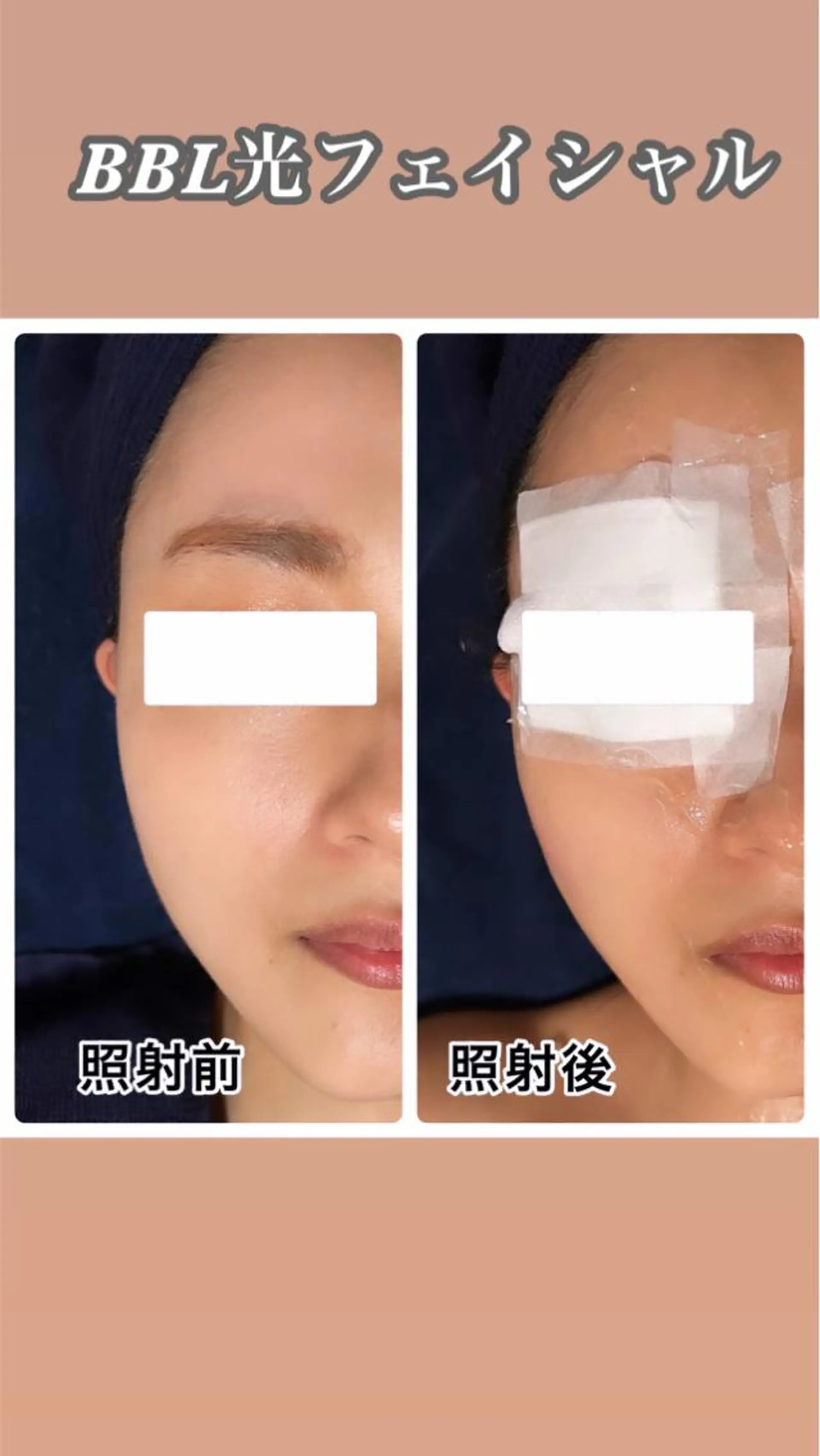 🌴Beauty Salon LANAのエステ・リラクイメージ