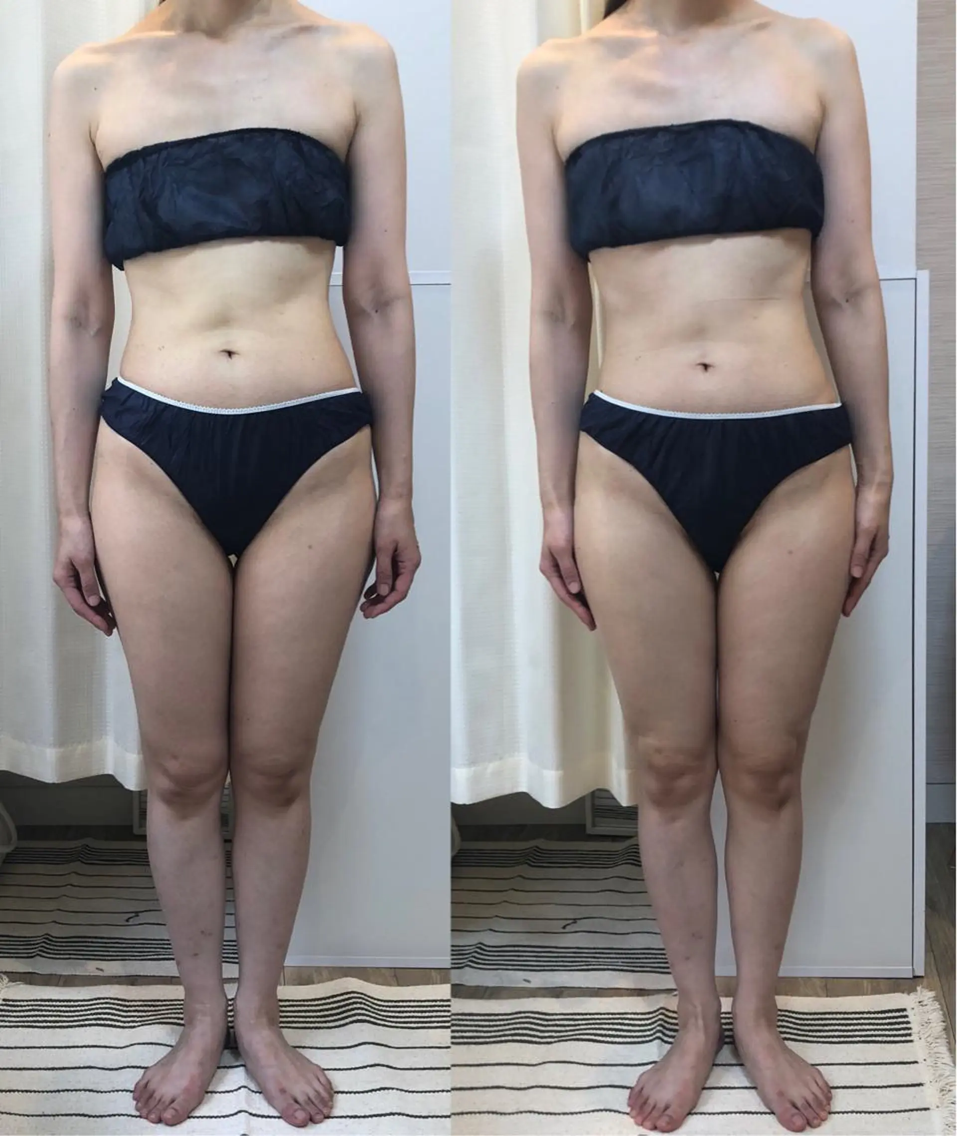 ROOM.S |脱毛|美肌|ボディのエステ・リラクイメージ