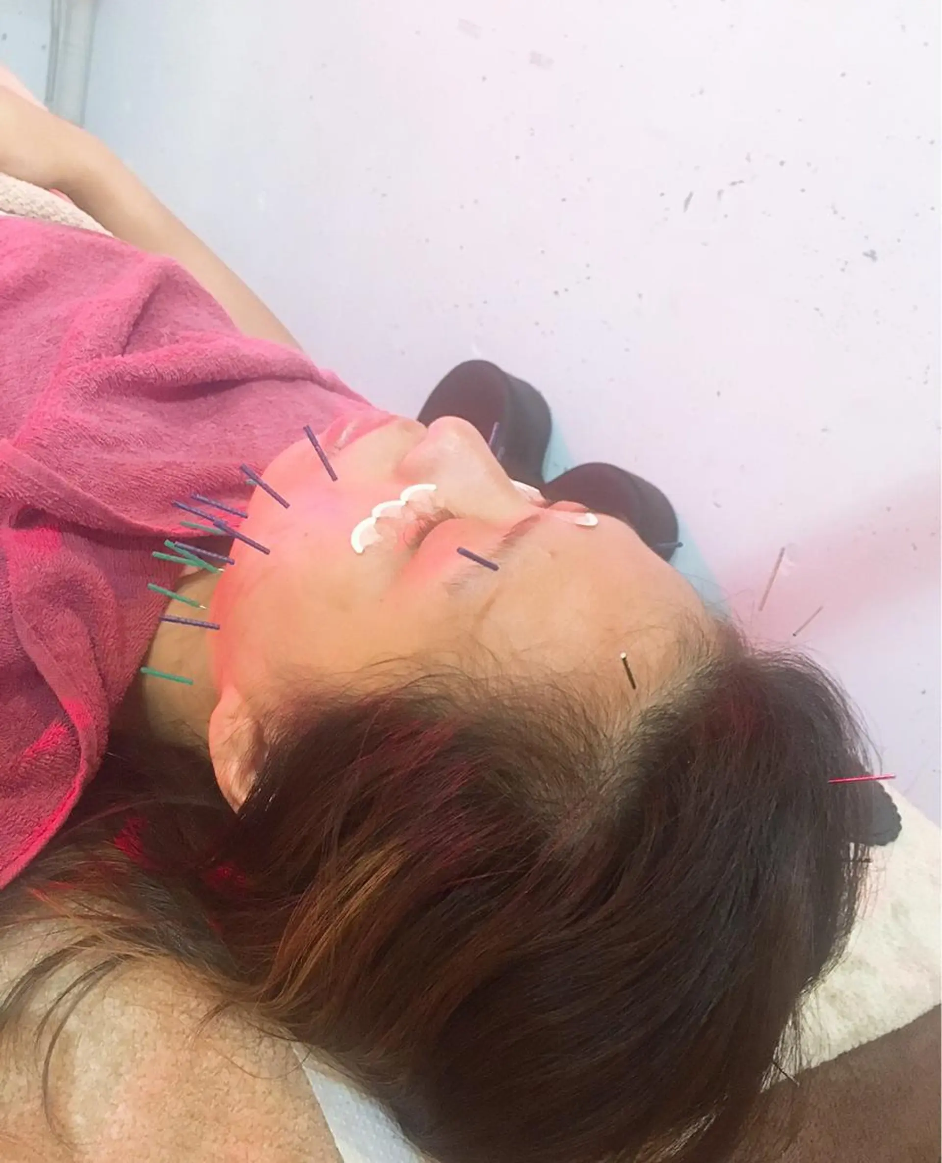 美容鍼灸女性専用 りんご鍼灸治療院のその他イメージ