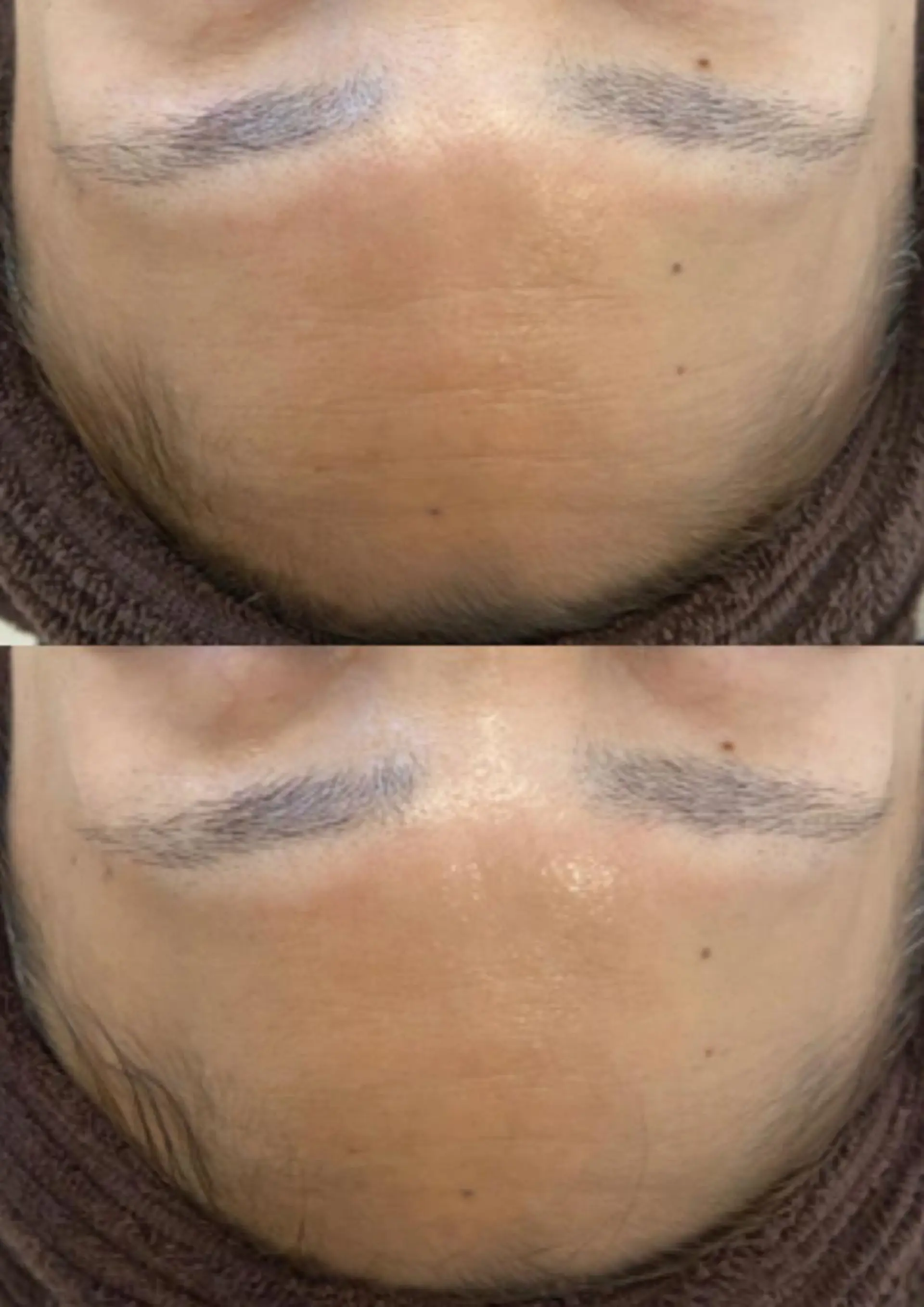 ROOM.S ｜脱毛｜美肌｜ボディのエステ・リラクイメージ