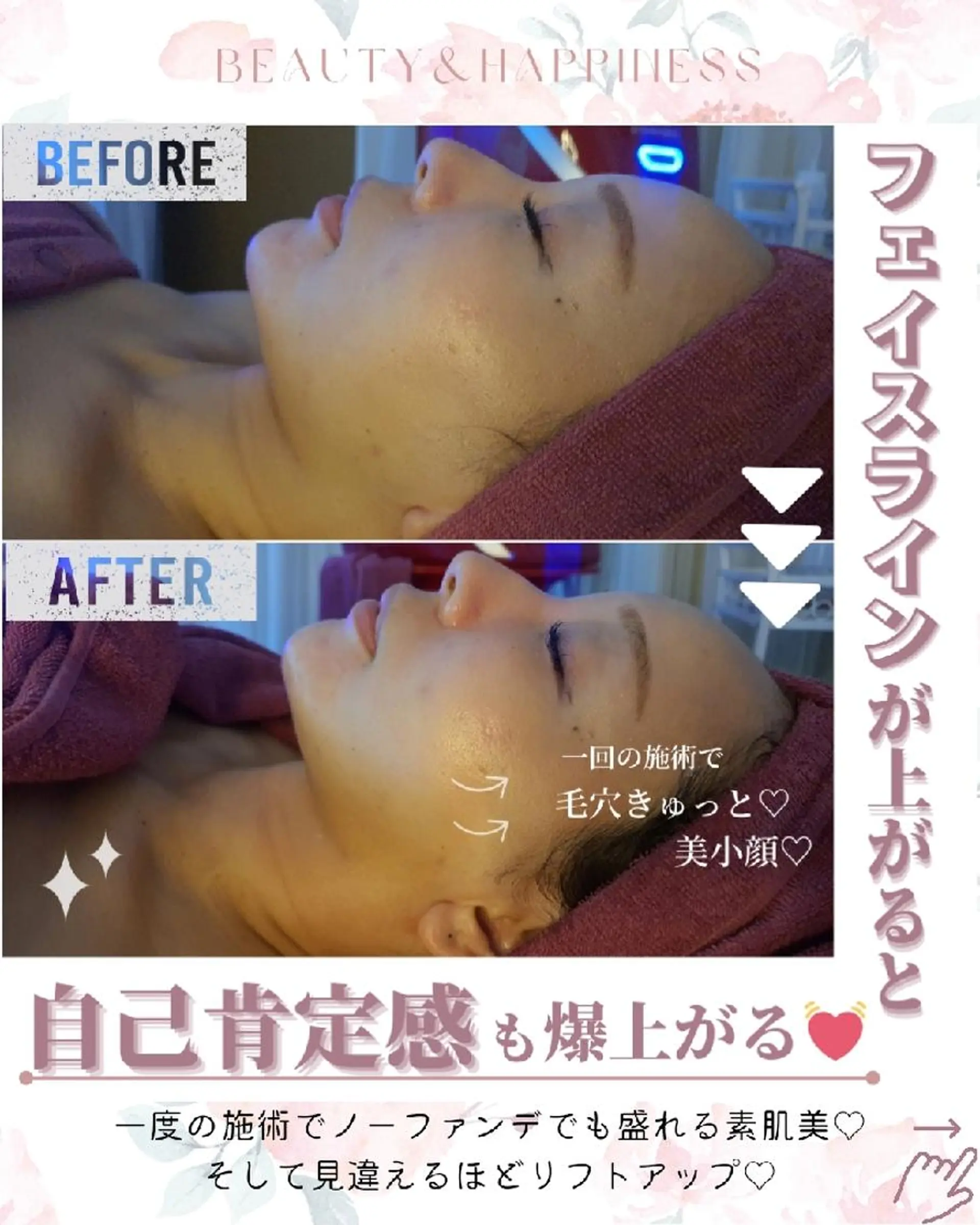 痩身ハーブピーリング 筋膜リリース☆B&Hのエステ・リラクイメージ