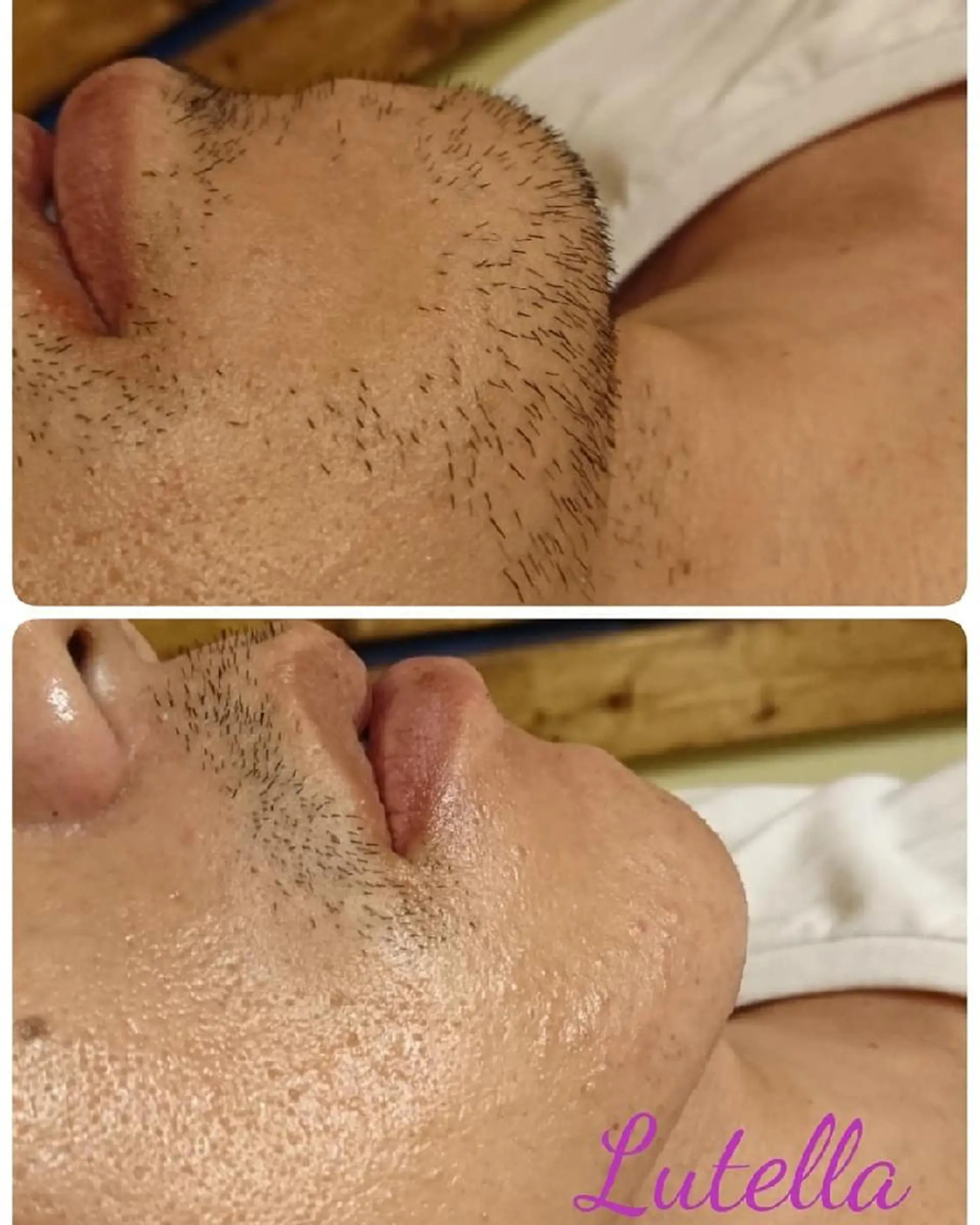 メンズ Lutella所属・ワックス脱毛専門店 Lutellaのエステ・リラクイメージ