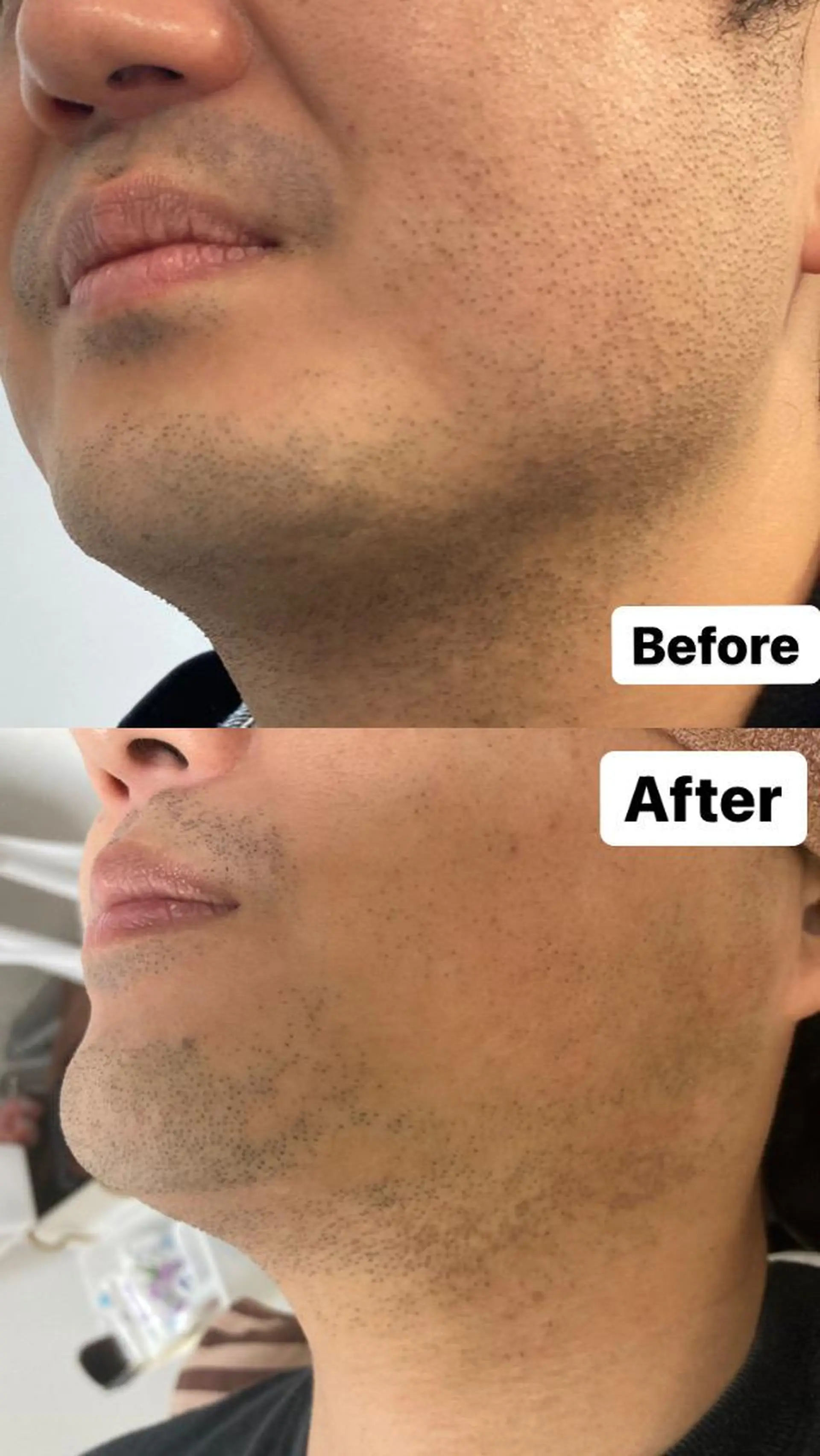 メンズ トータルビューティー サロンCherie2のエステ・リラクイメージ