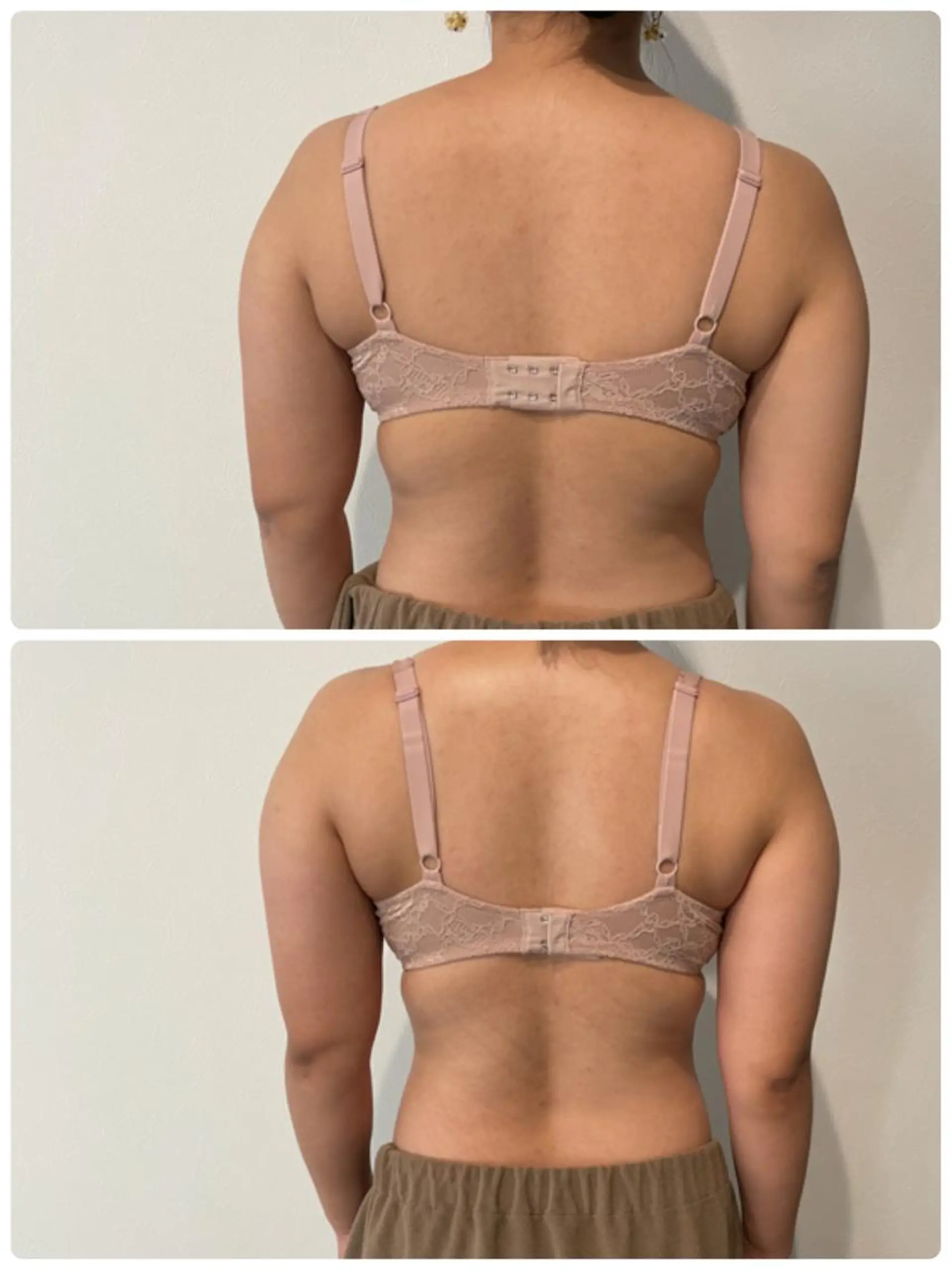 Monreve所属・美人スイッチdiet スーパージェクションのその他イメージ