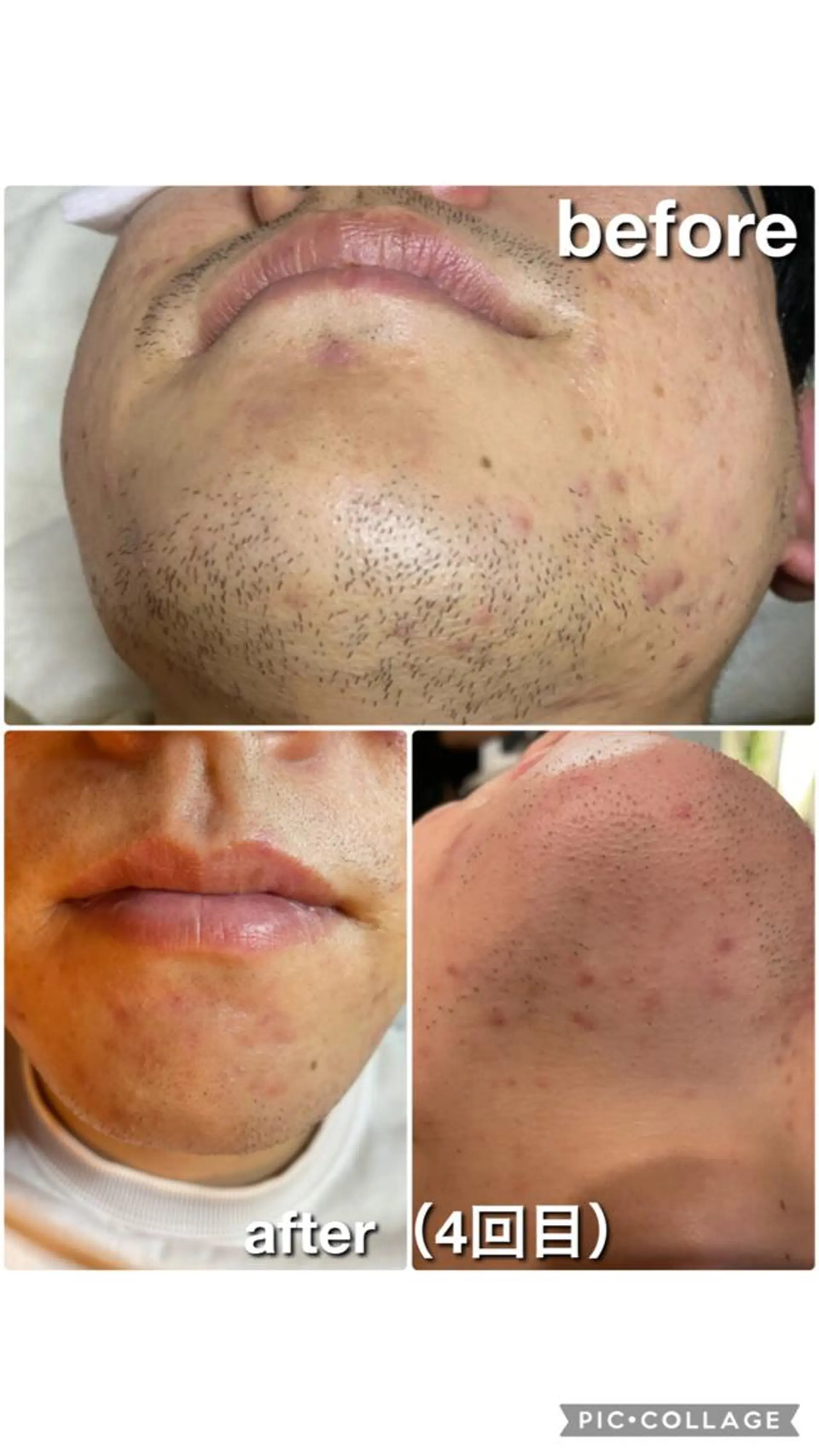 メンズ メンズ脱毛専門店oasis所属・メンズ脱毛専門店 oasisのエステ・リラクイメージ