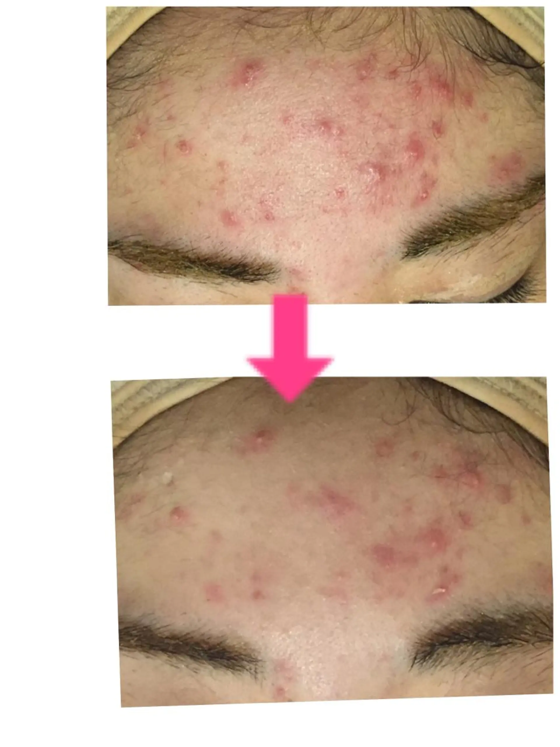 ロング カラー パーマ ヘアアレンジ メンズ キッズ ネイル マツエク・マツパ ‍痩身＆ボディ 結果出し🌟丹野のエステ・リラクイメージ