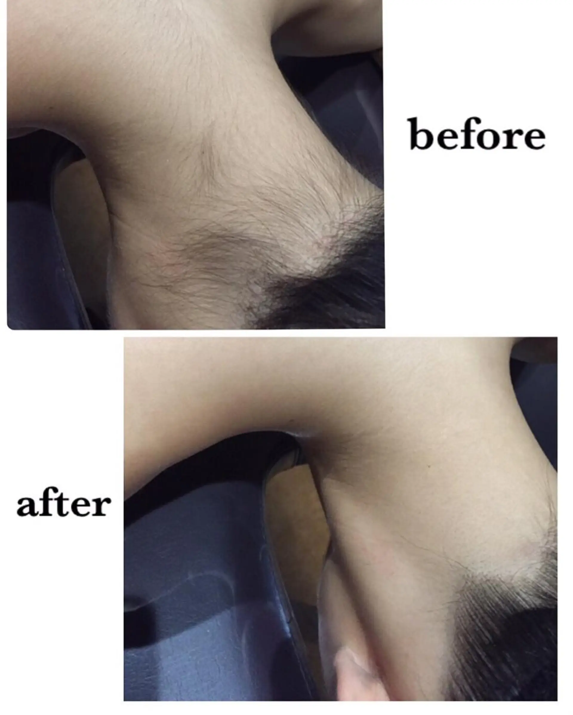 脱毛 Ange -viva la vida-所属・Ange vivalavidaのエステ・リラクイメージ