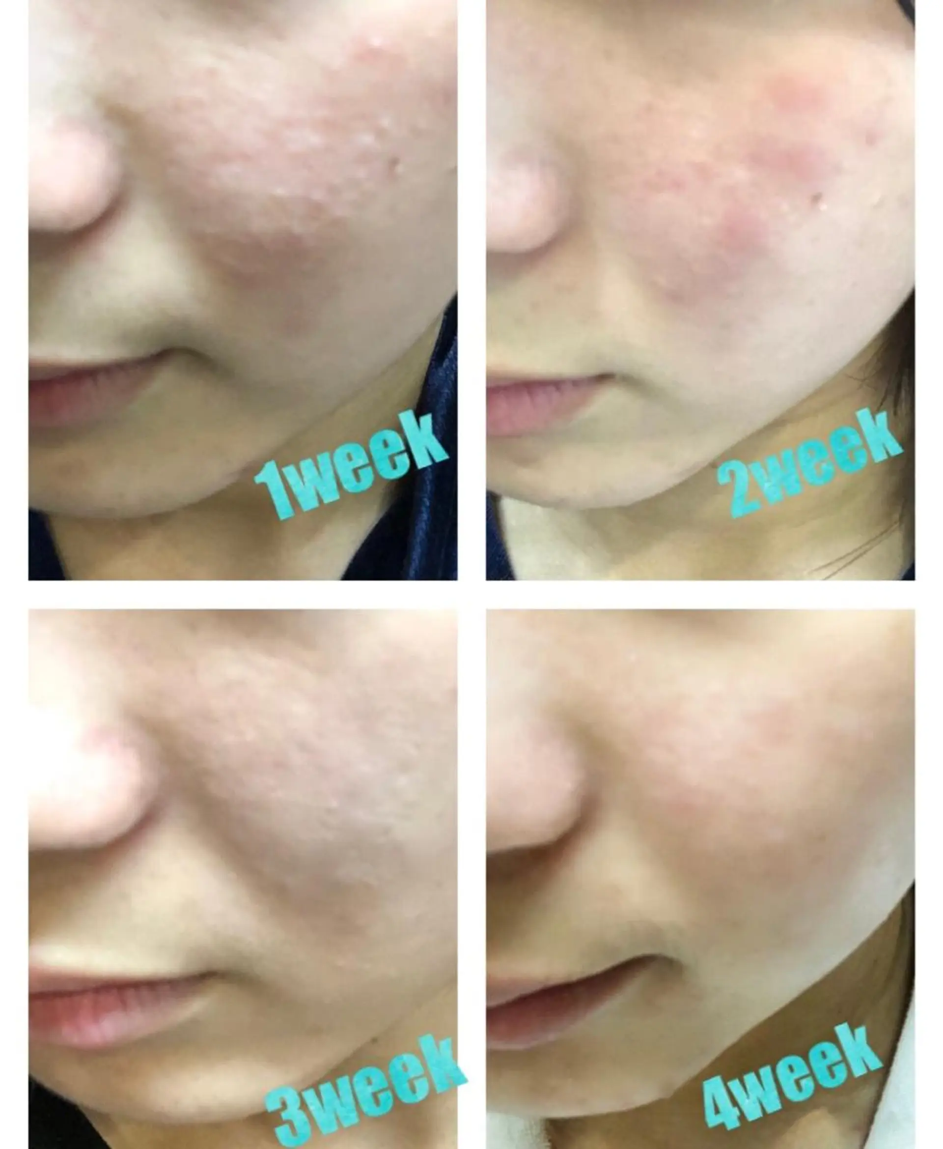 ミューズエステ 谷口美結のエステ・リラクイメージ