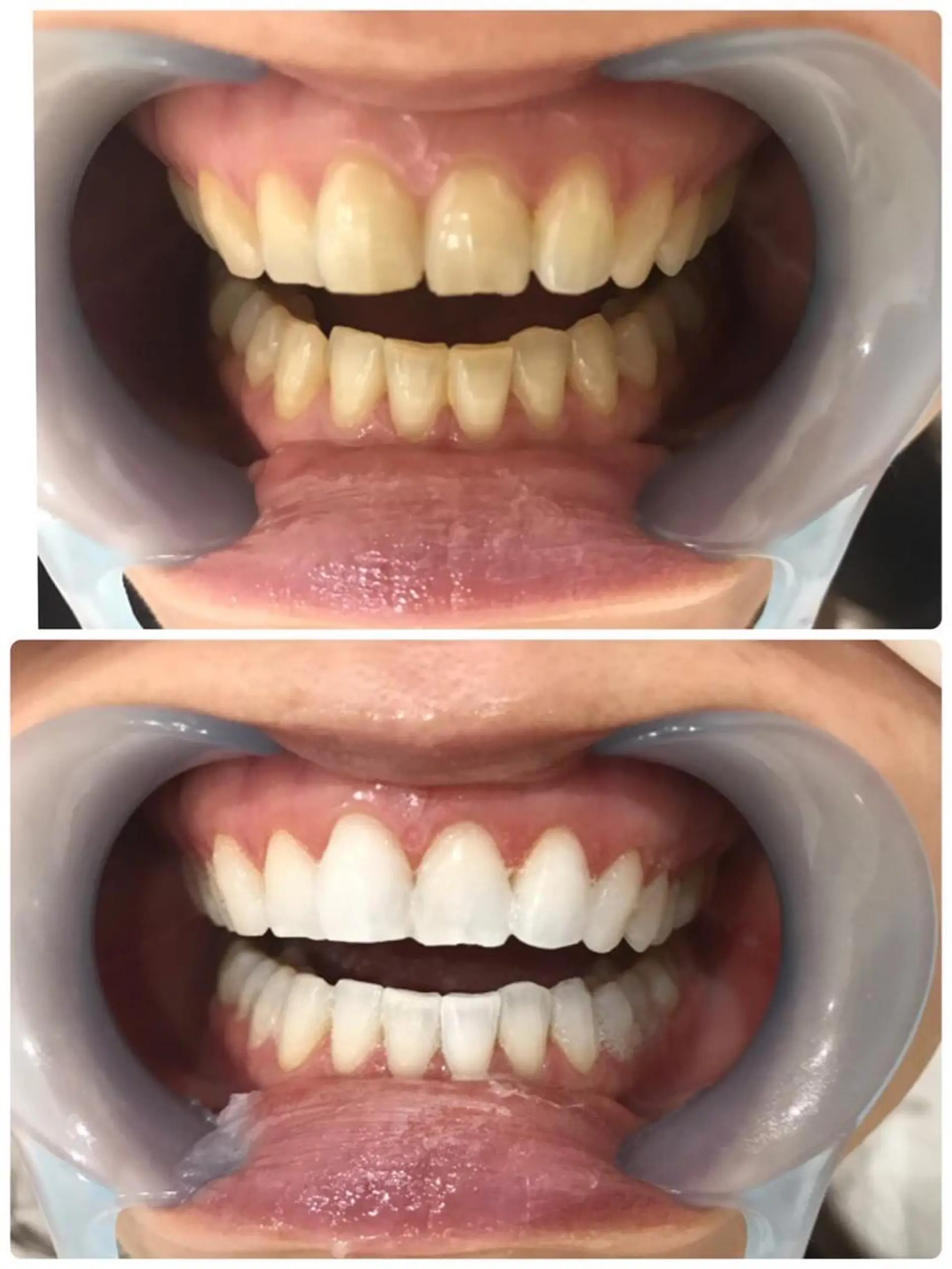 Monreve所属・美人スイッチdiet スーパージェクションのその他イメージ