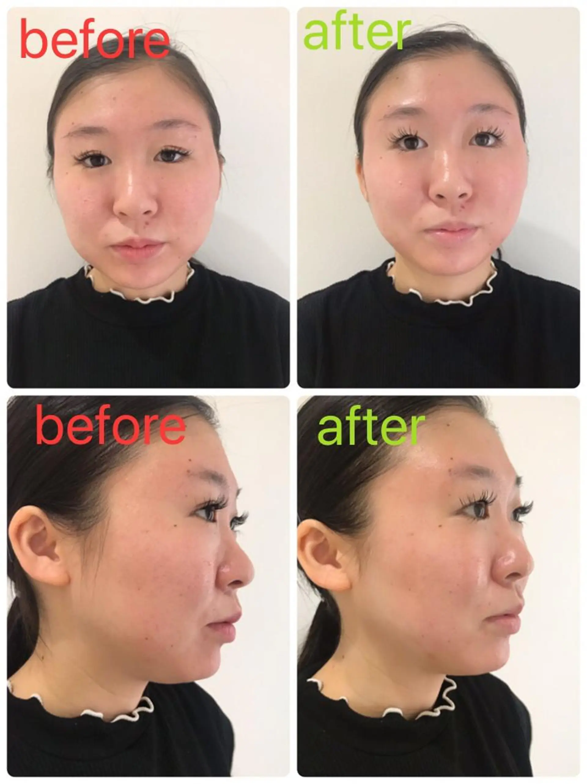 エステ リラク ポーラLumina 旧カヨー店のエステ・リラクイメージ