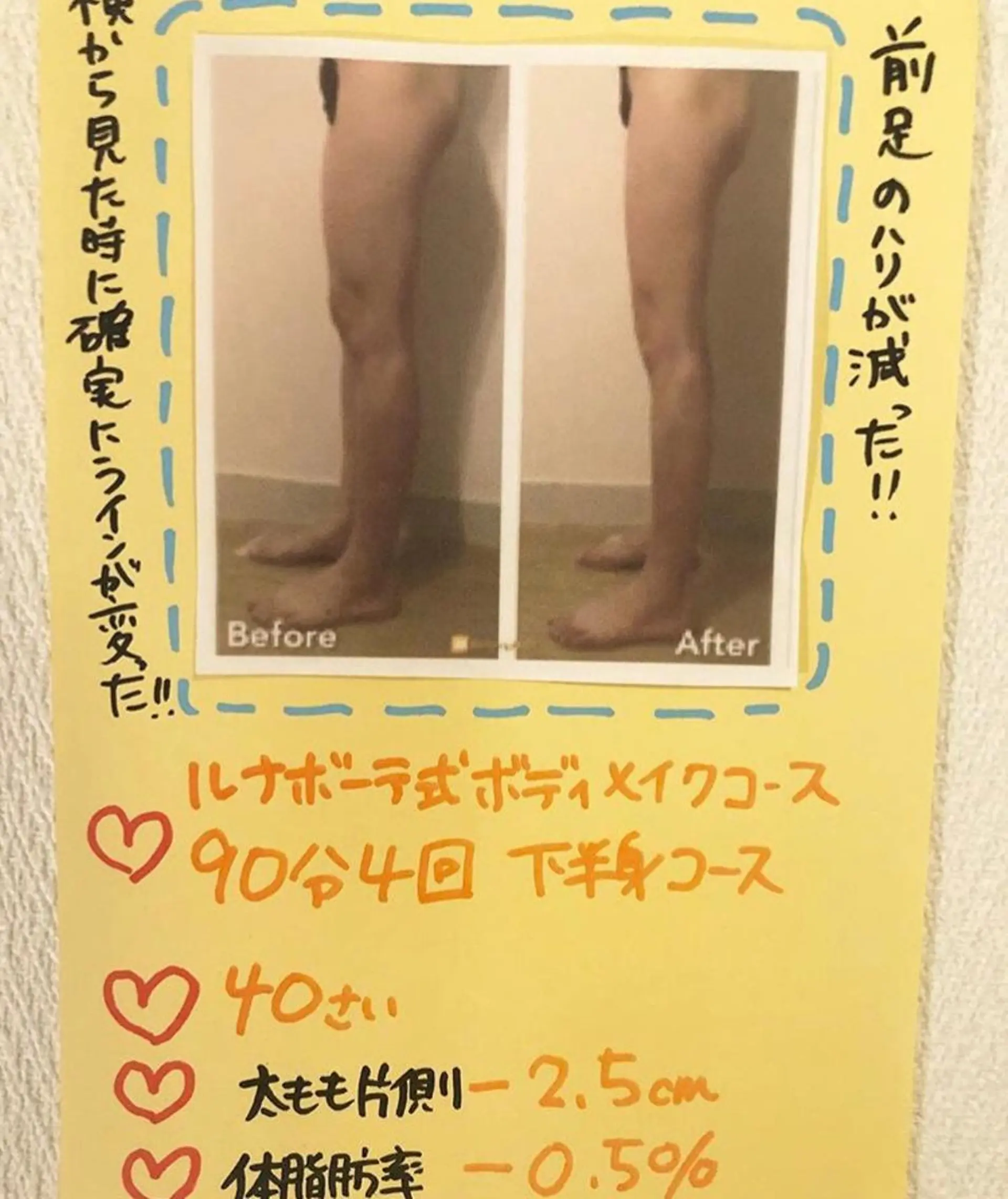 小尻・太もも痩せる エステルナボーテのエステ・リラクイメージ