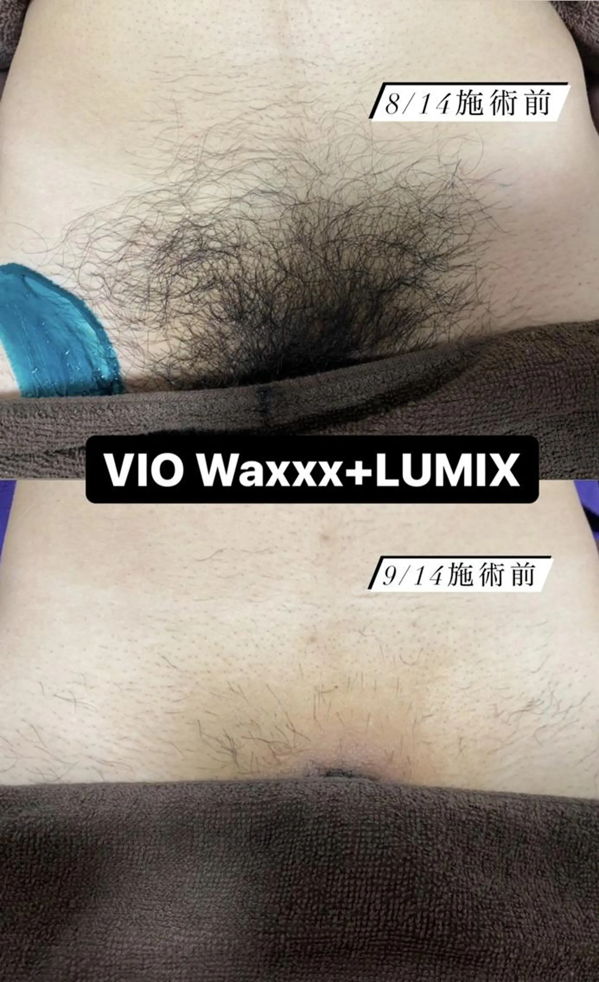 メンズ 脱毛 Epina 千葉店 【エピナ】のエステ・リラクイメージ