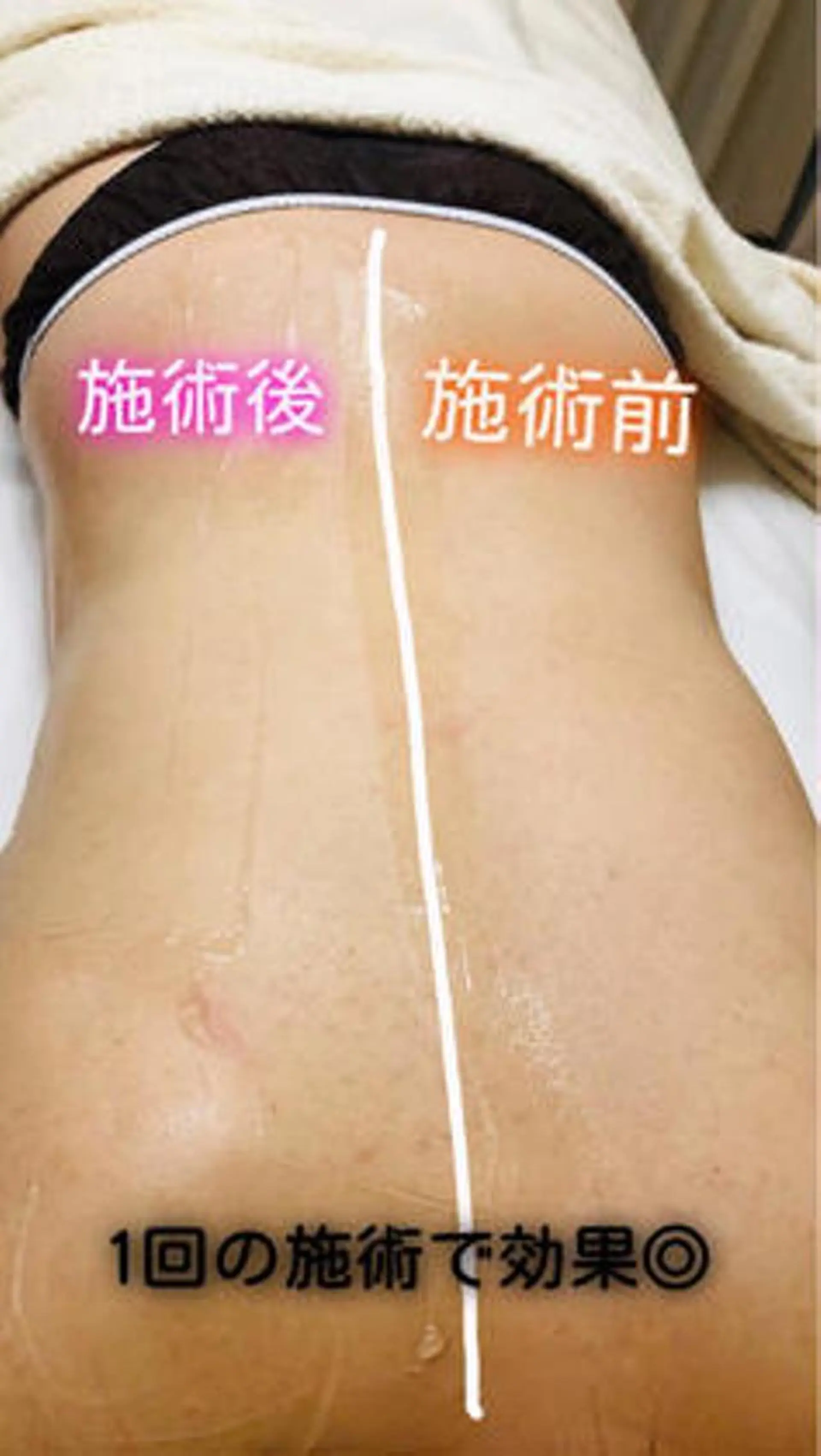 エステ 美肌脱毛ｻﾛﾝark beautylab✨のエステ・リラクイメージ