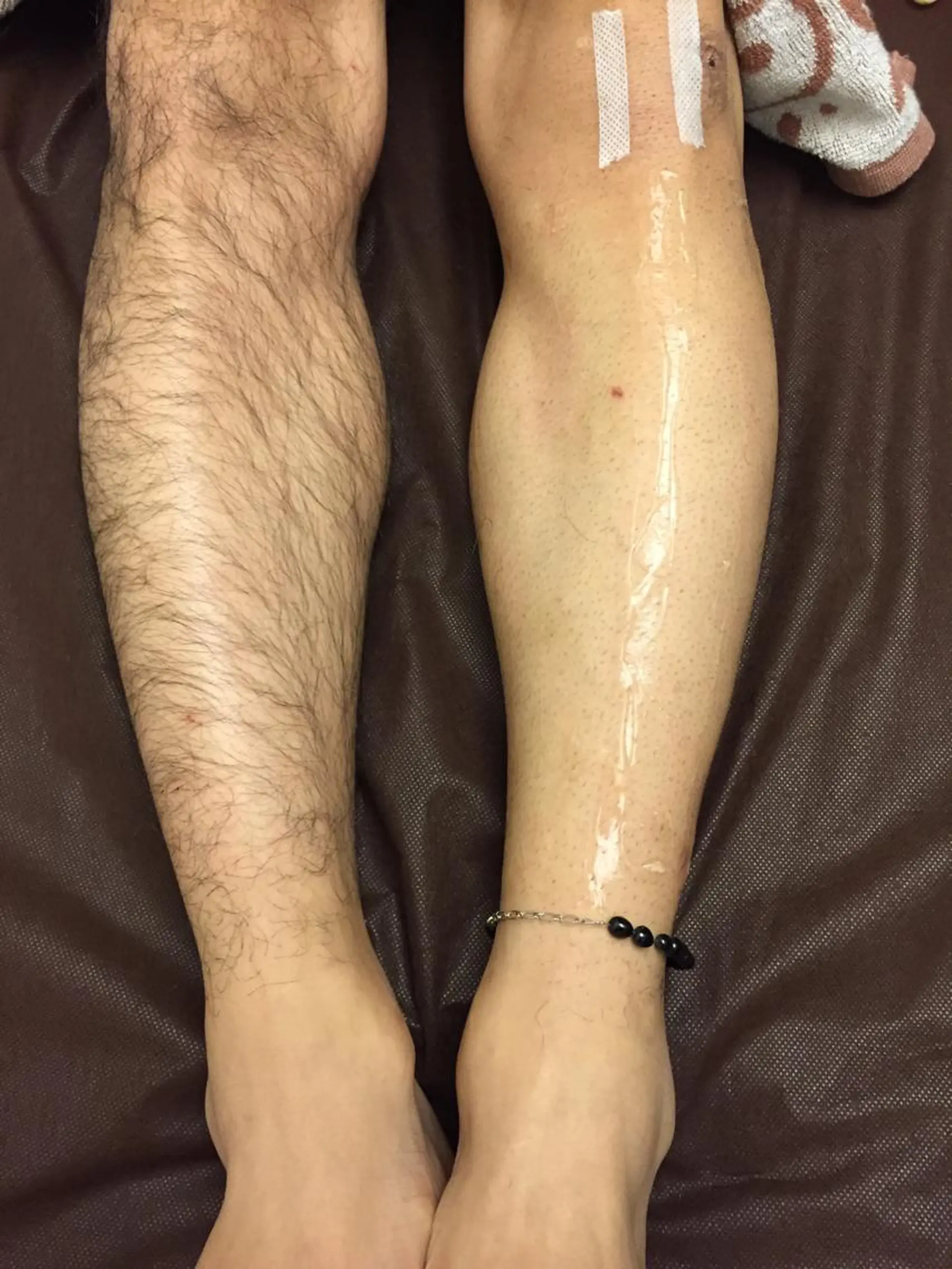 トータルビューティー マウロアのエステ・リラクイメージ