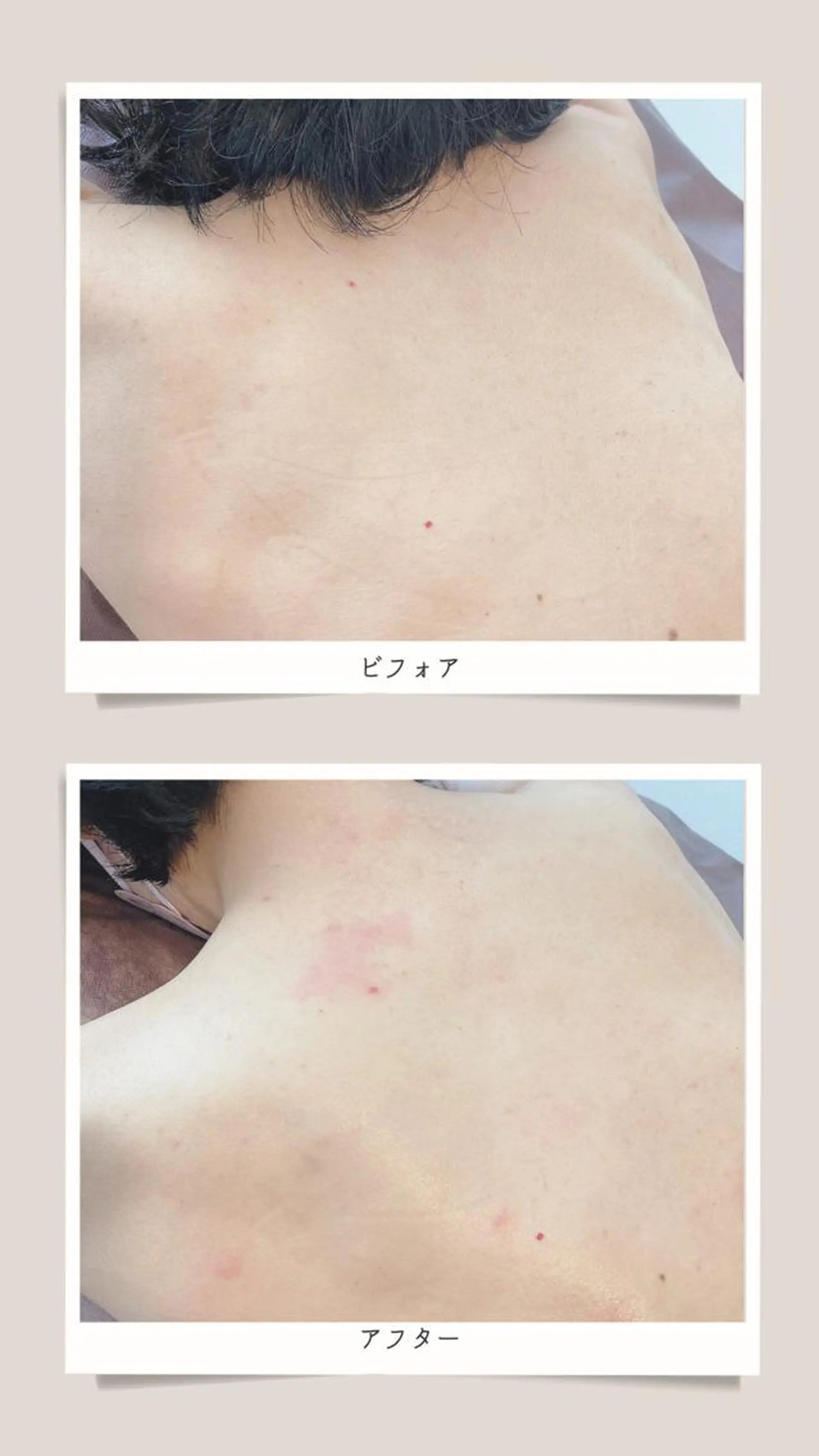 脱毛 Asano Makikoのエステ・リラクイメージ