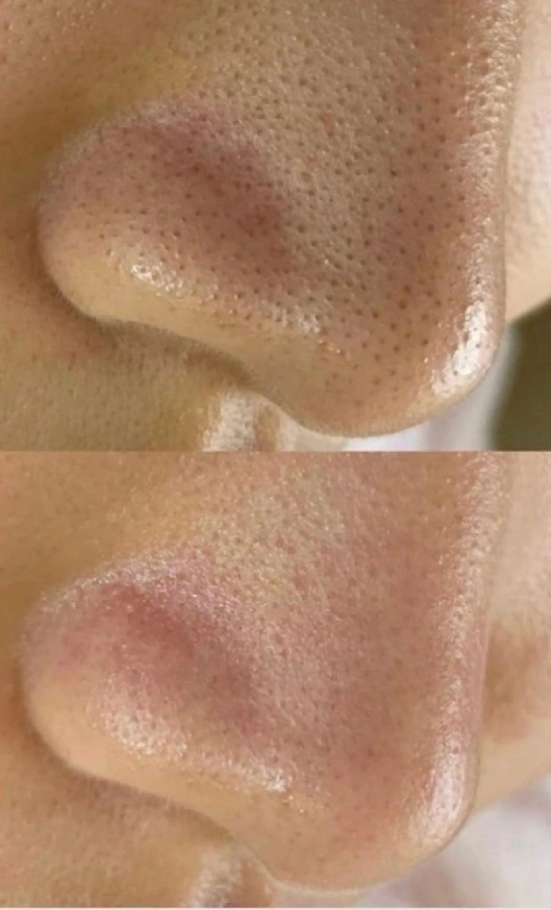 エステ 毛穴/毛穴洗浄専門 エミルカ船橋のエステ・リラクイメージ