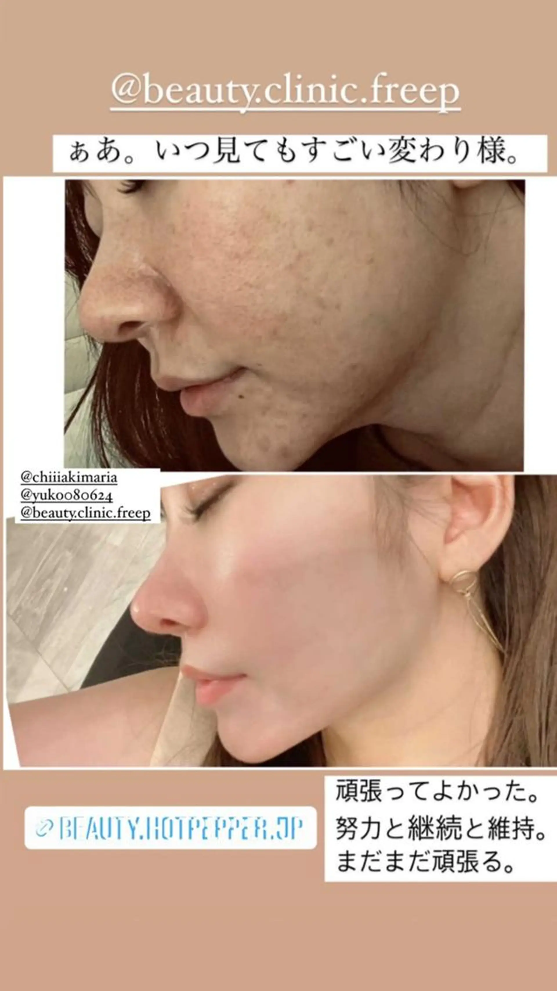 エステfreep takamoriのエステ・リラクイメージ