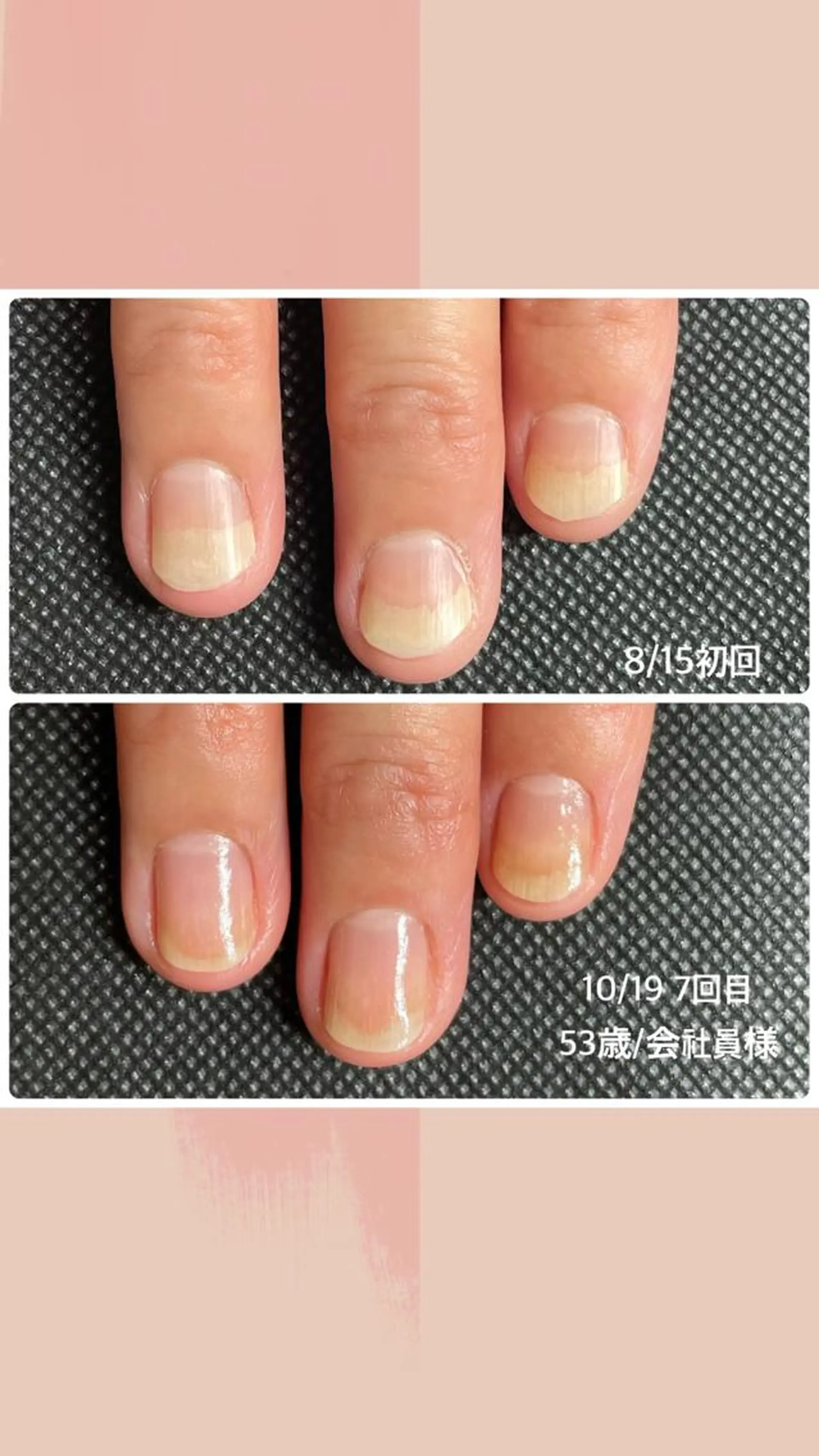 ネイル 奥園 良恵のネイルデザイン