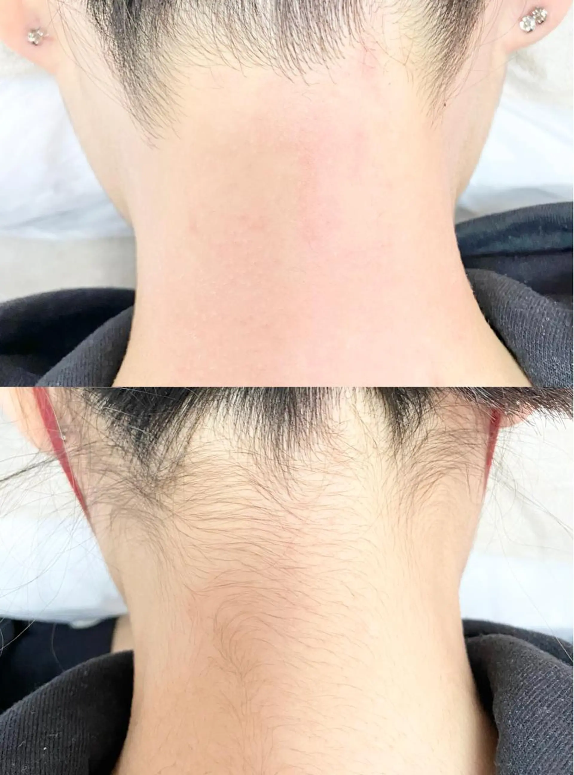 脱毛 &me ayakaのエステ・リラクイメージ