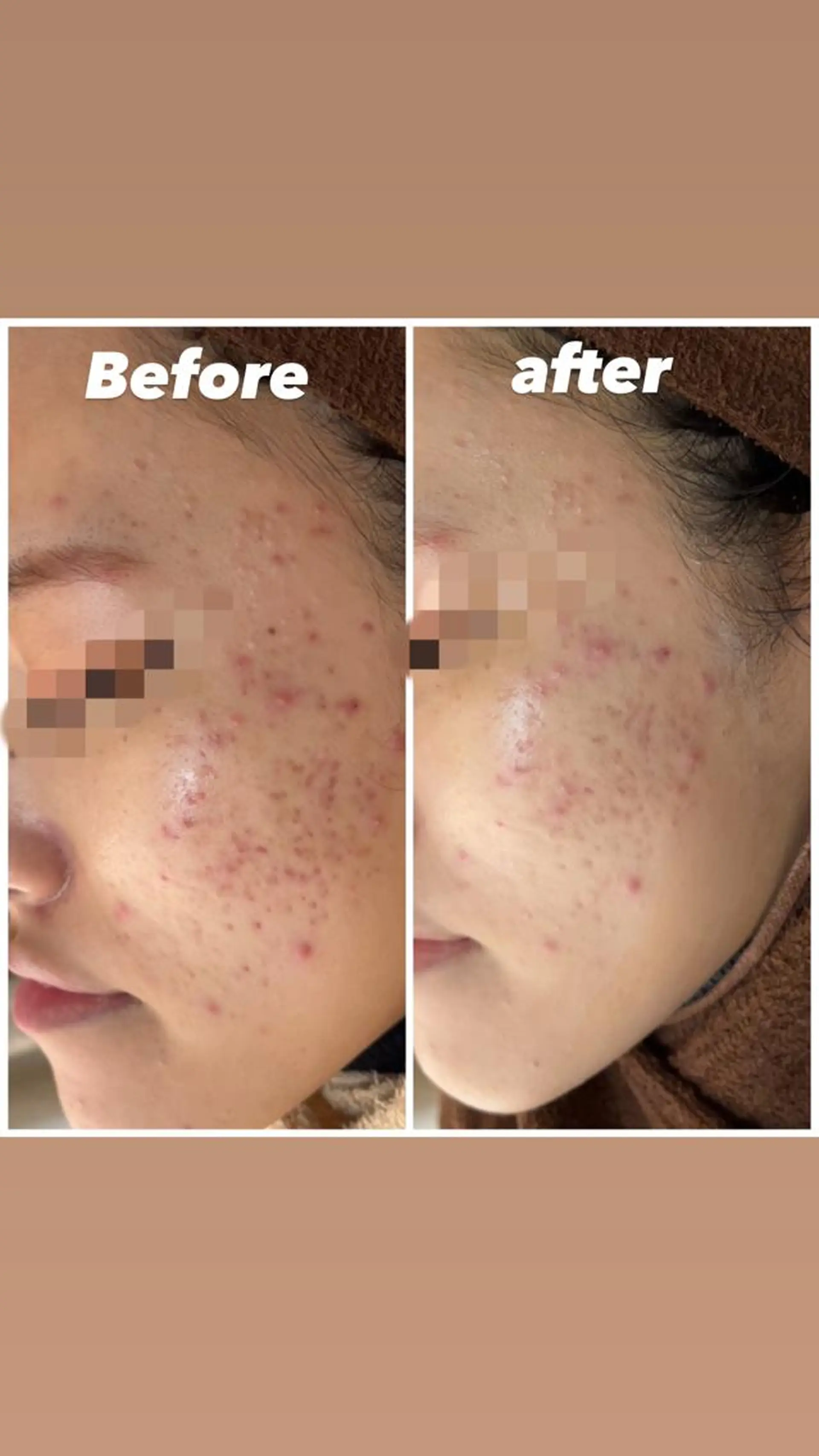 ショート カラー パーマ ヘアアレンジ メンズ キッズ ネイル マツエク・マツパ アイブロウ Amaryllis 🌹のエステ・リラクイメージ