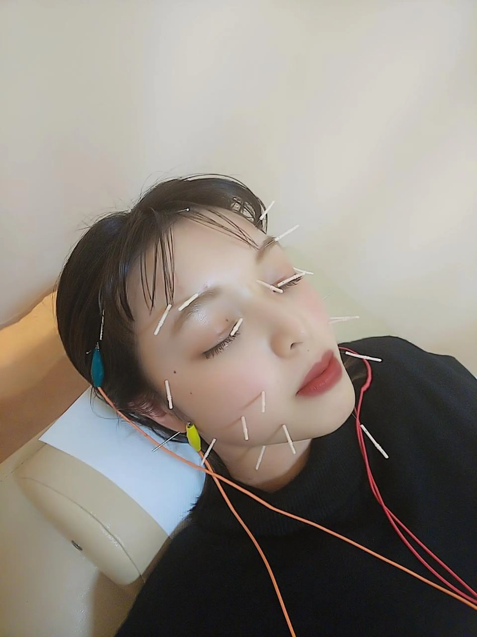 お顔のむくみたるみ 専門☆美容鍼小顔矯正のエステ・リラクイメージ