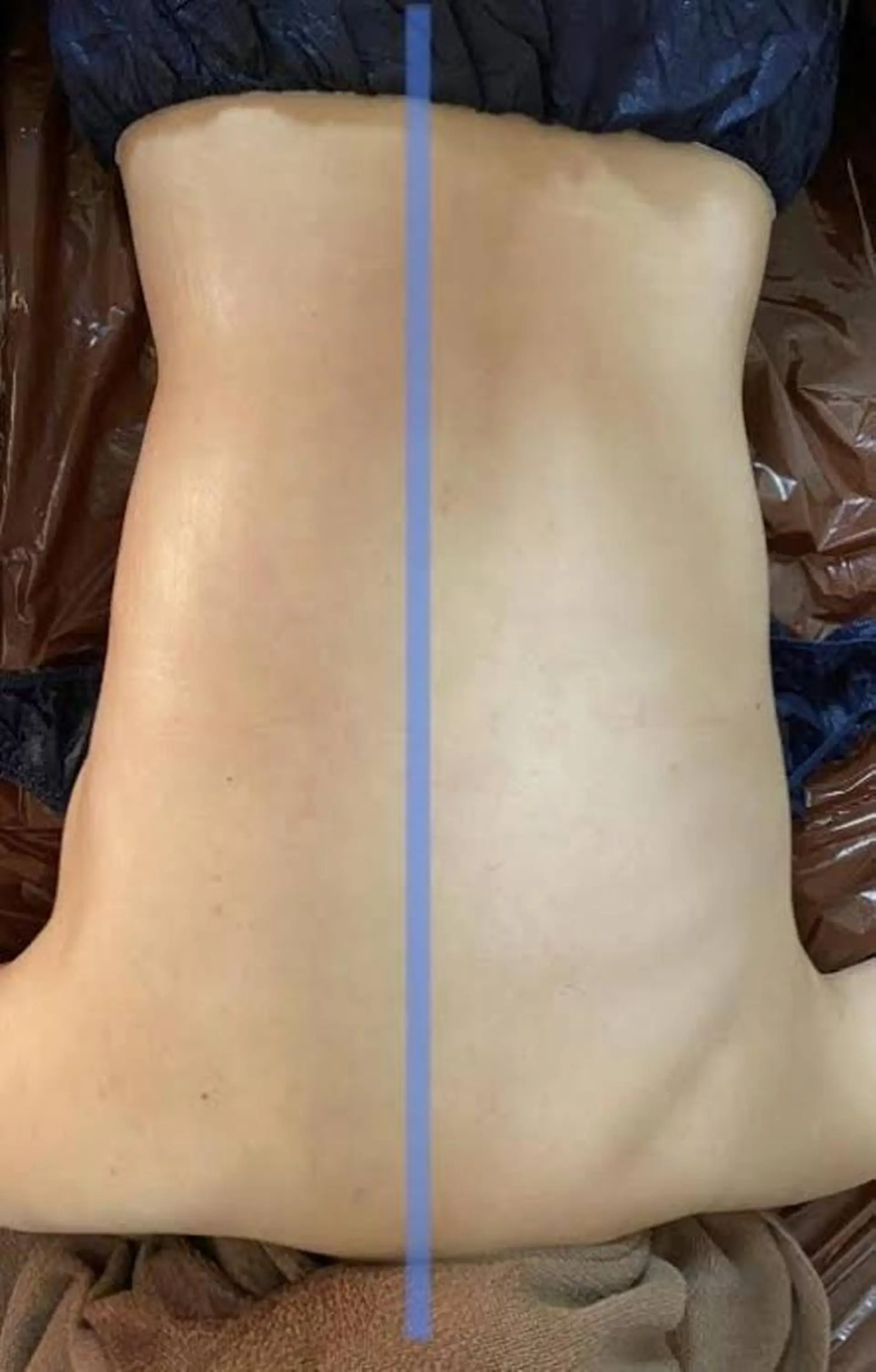 RAYVIS梅田店 HARUのエステ・リラクイメージ