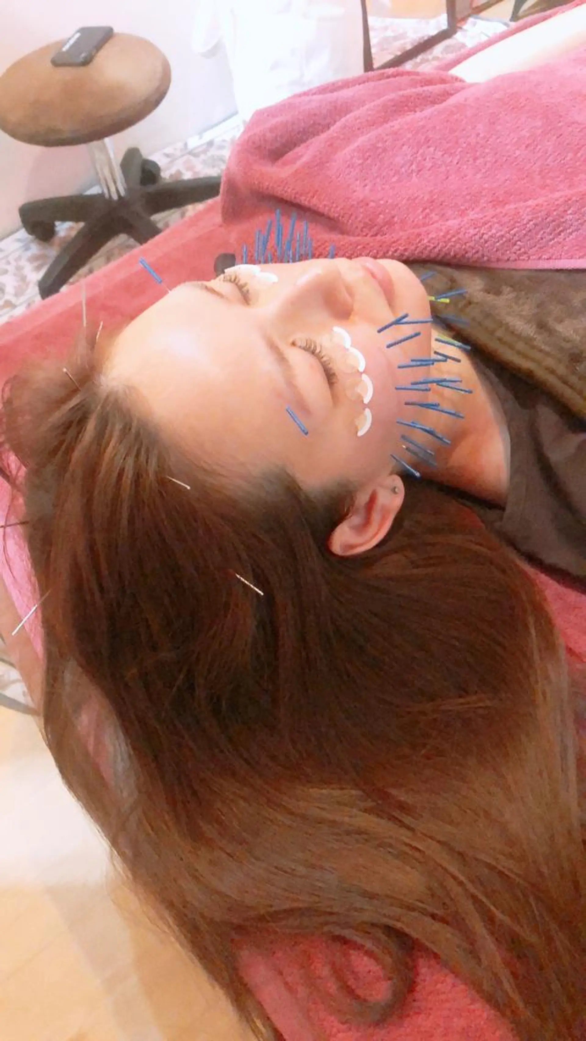 美容鍼灸女性専用 りんご鍼灸治療院のその他イメージ