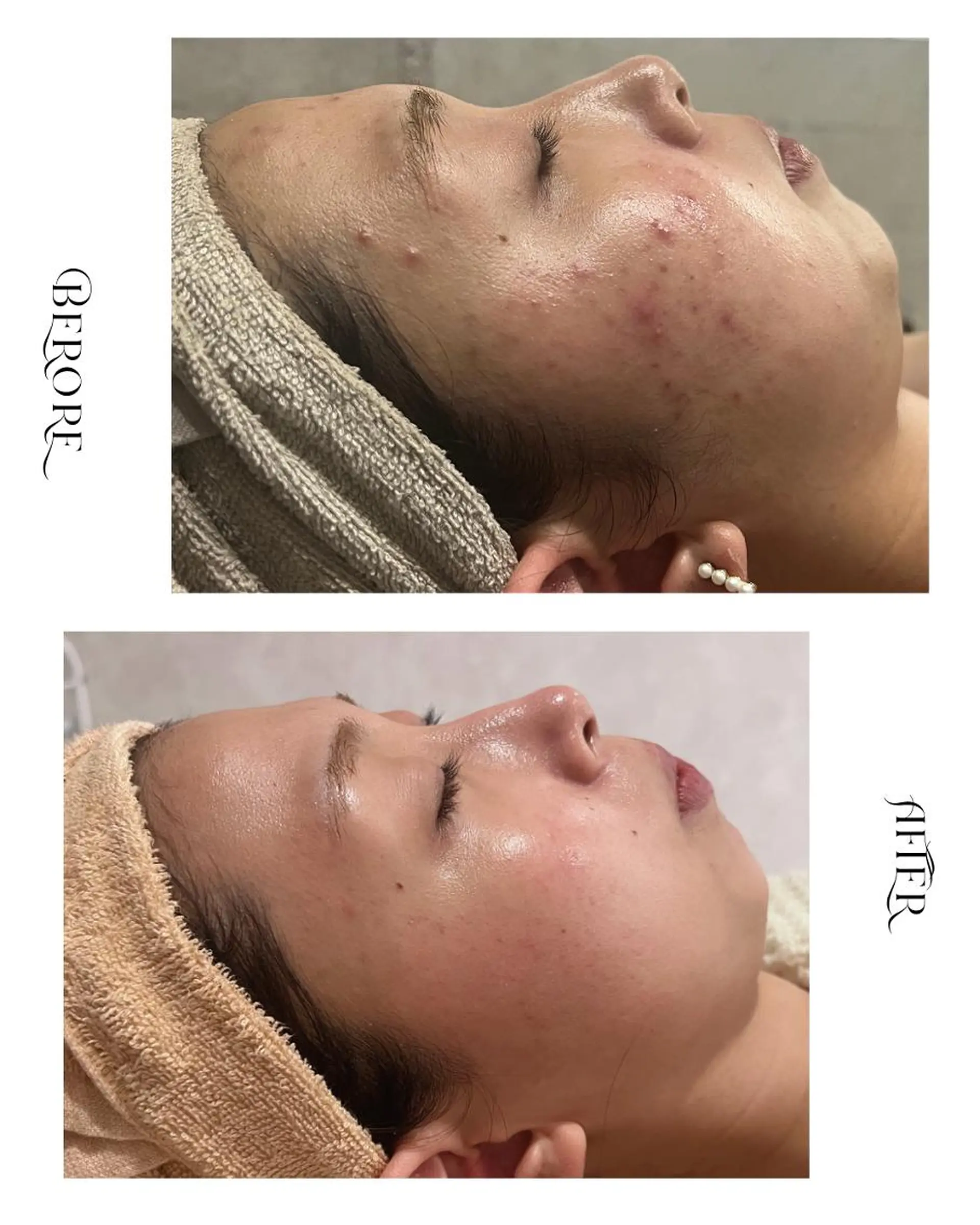 脱毛・肌質改善サロン Linoのエステ・リラクイメージ