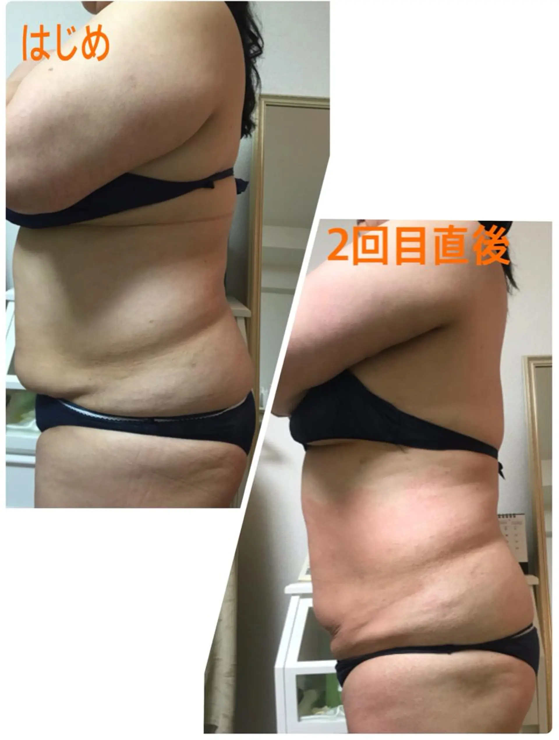 横浜ビューティーファクトリーHANA元町店所属・エステ＆アロマ HANAのエステ・リラクイメージ