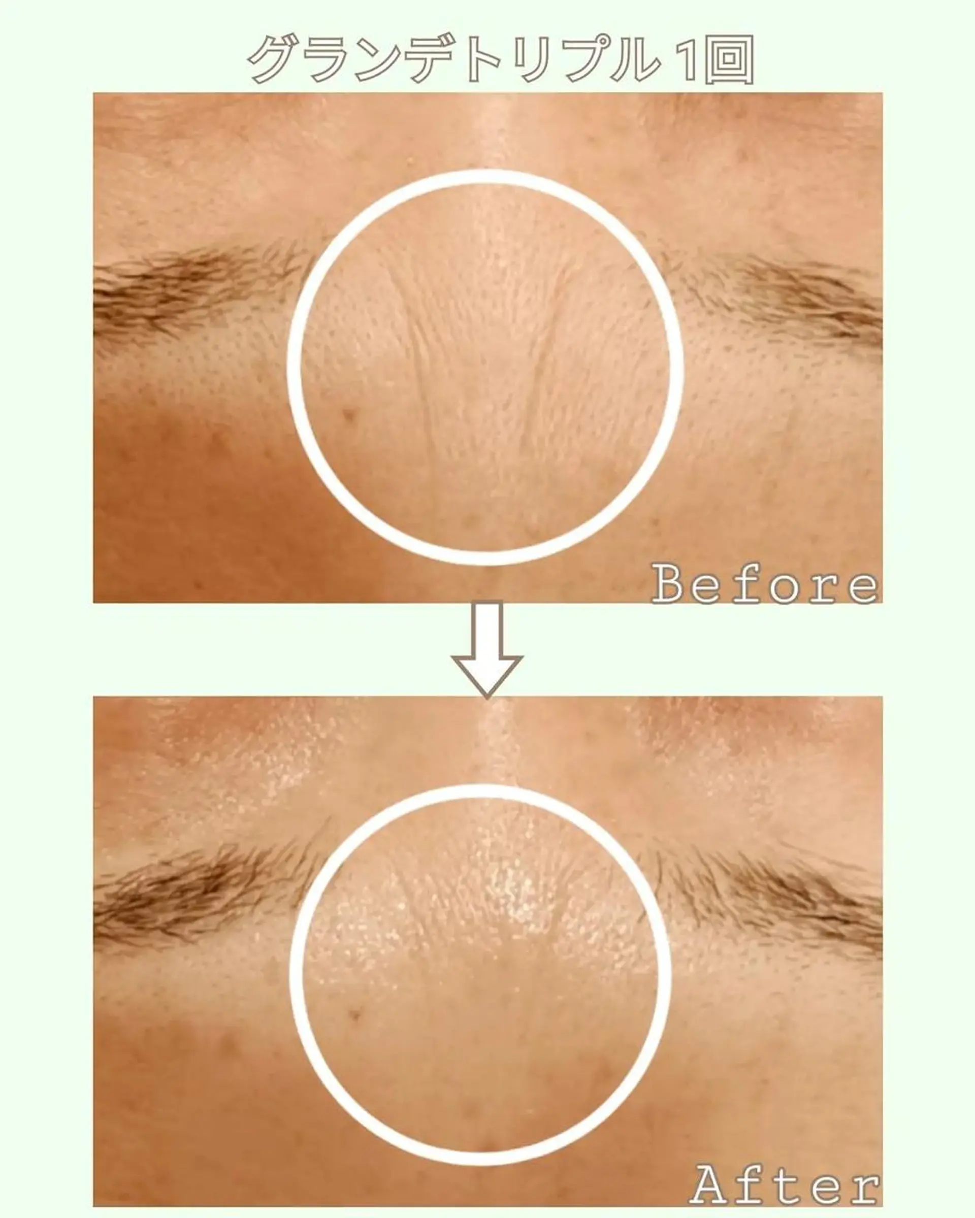 ラブニール 恵比寿店のエステ・リラクイメージ