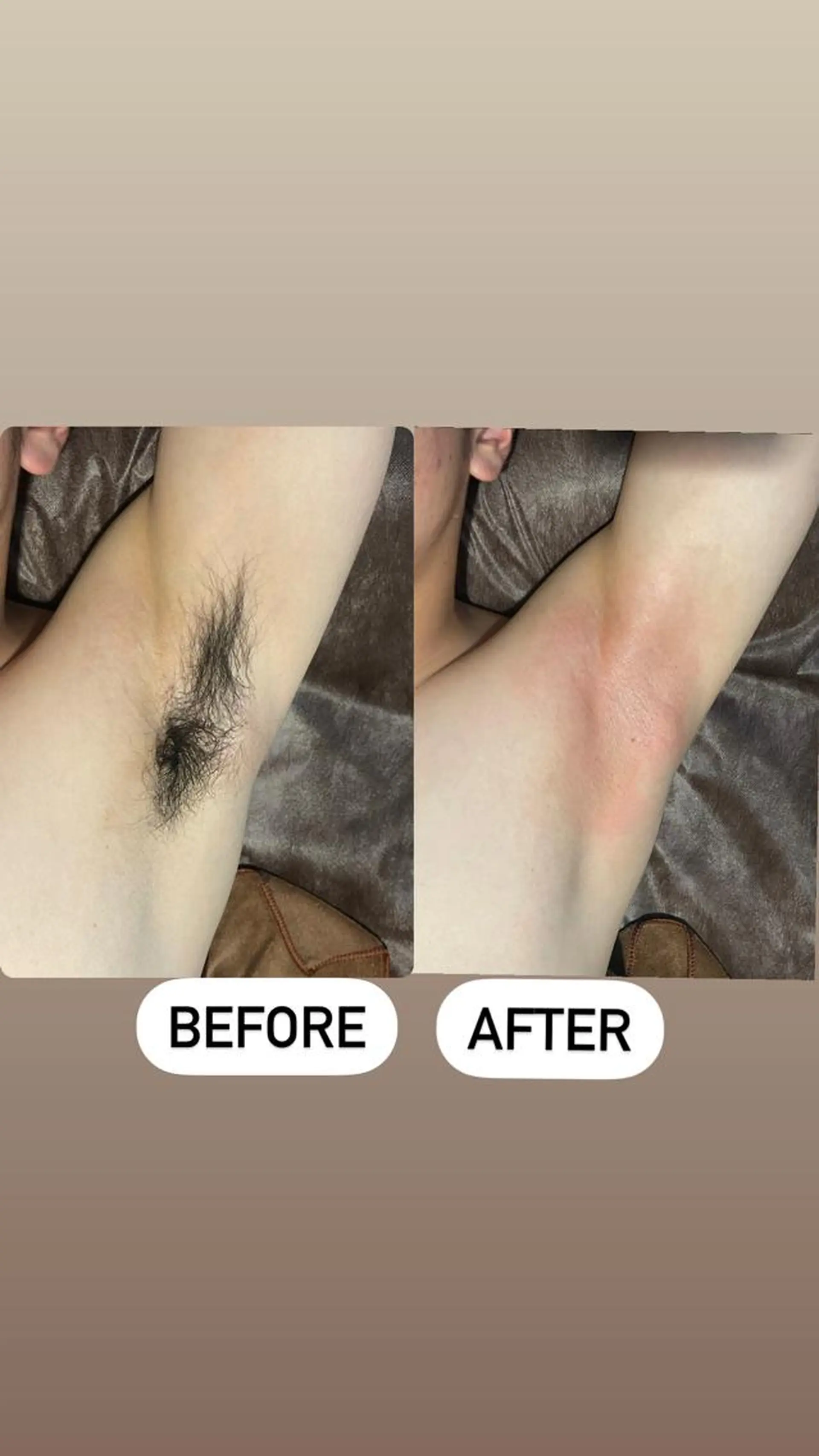 メンズ 脱毛 メンズ眉毛ITSUK Iメンズ専門　新宿の眉毛・アイブロウイメージ