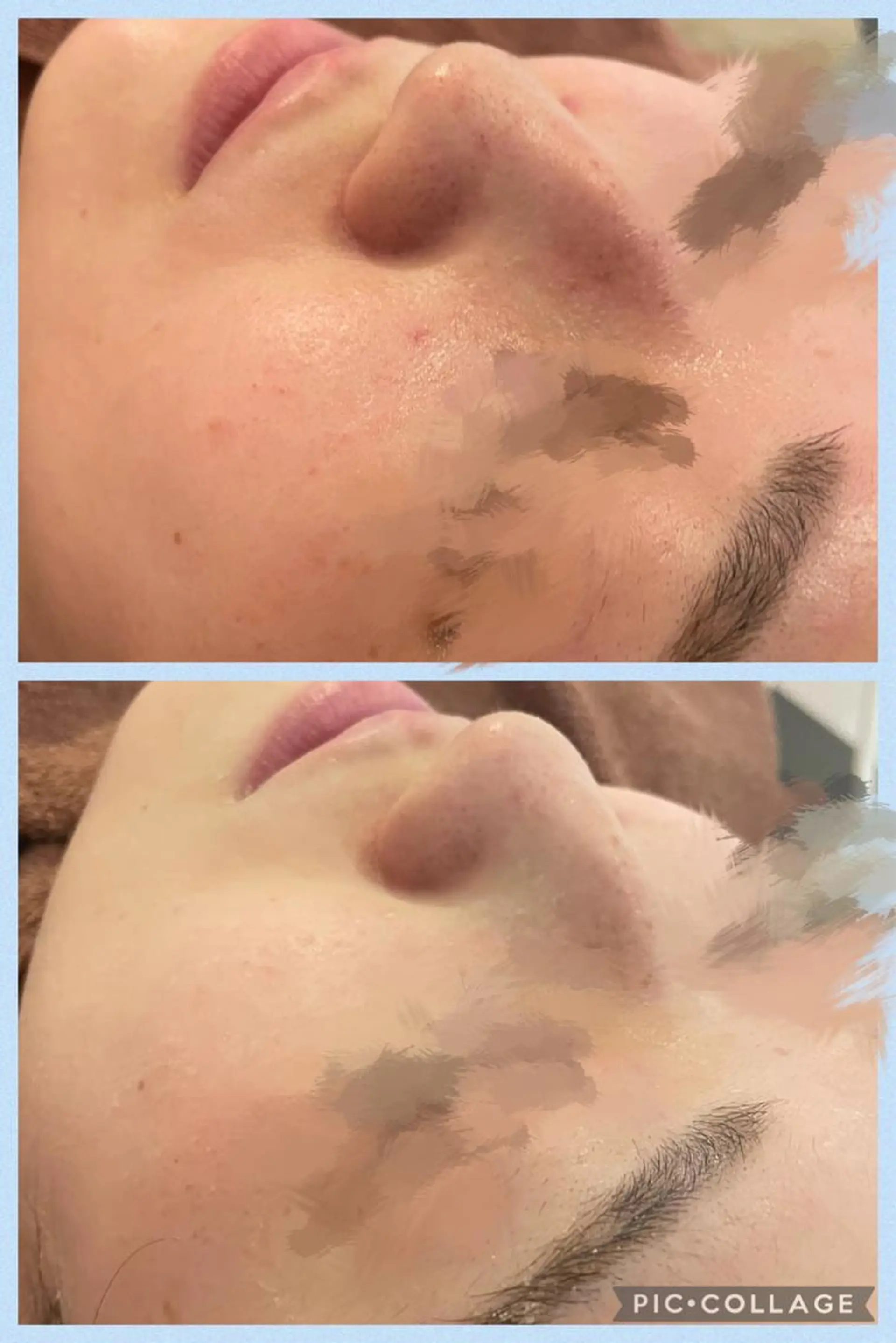 ロング カラー パーマ ヘアアレンジ メンズ キッズ ネイル マツエク・マツパ アイブロウ エステ リラク ニキビ特化型エステ 🍋最短で肌質改善のエステ・リラクイメージ