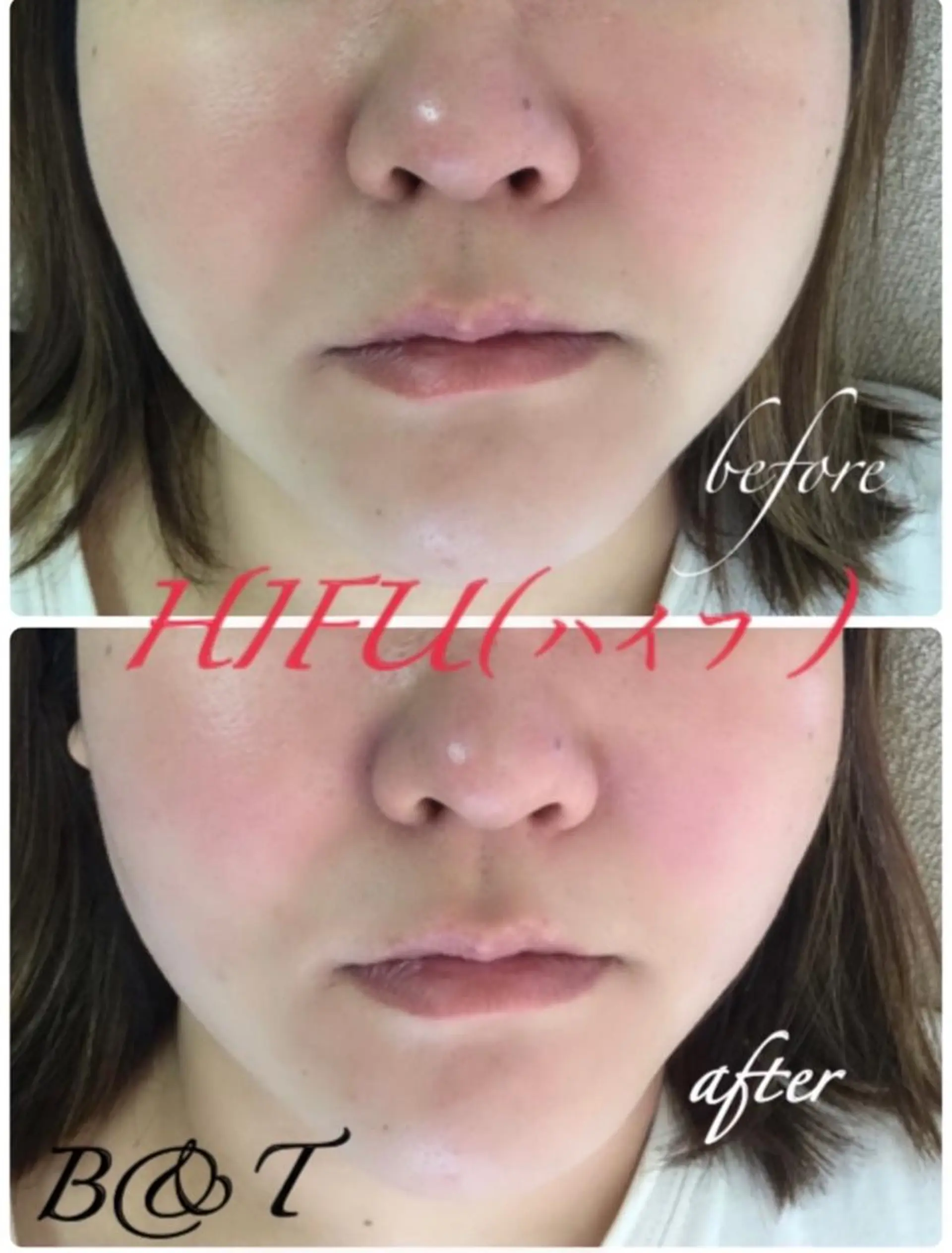 肌質改善サロン chouchouのエステ・リラクイメージ