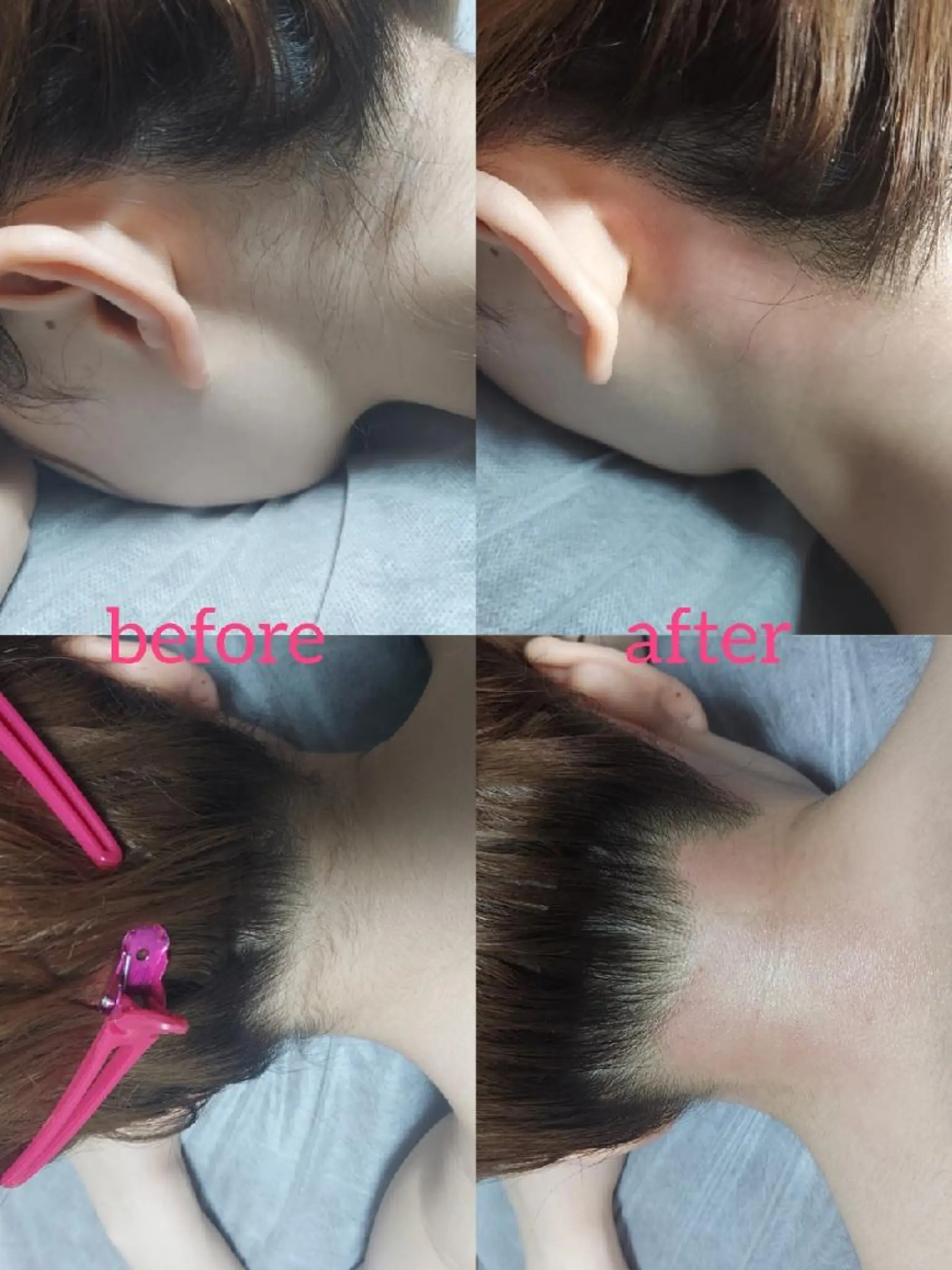 脱毛サロンLULA 恵比寿店濱野のエステ・リラクイメージ