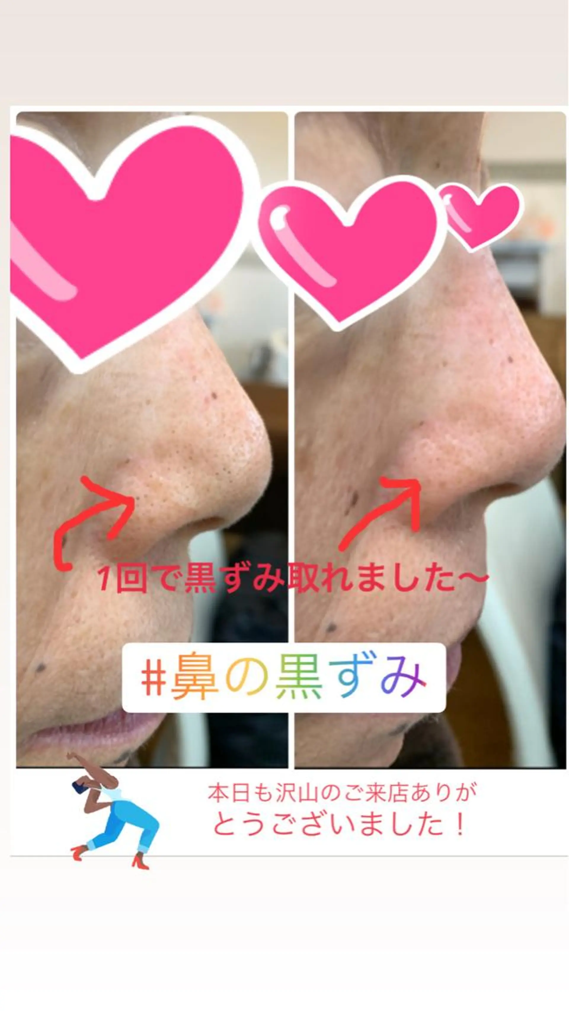 フェイシャルワックス 自然派エステファーノのその他イメージ