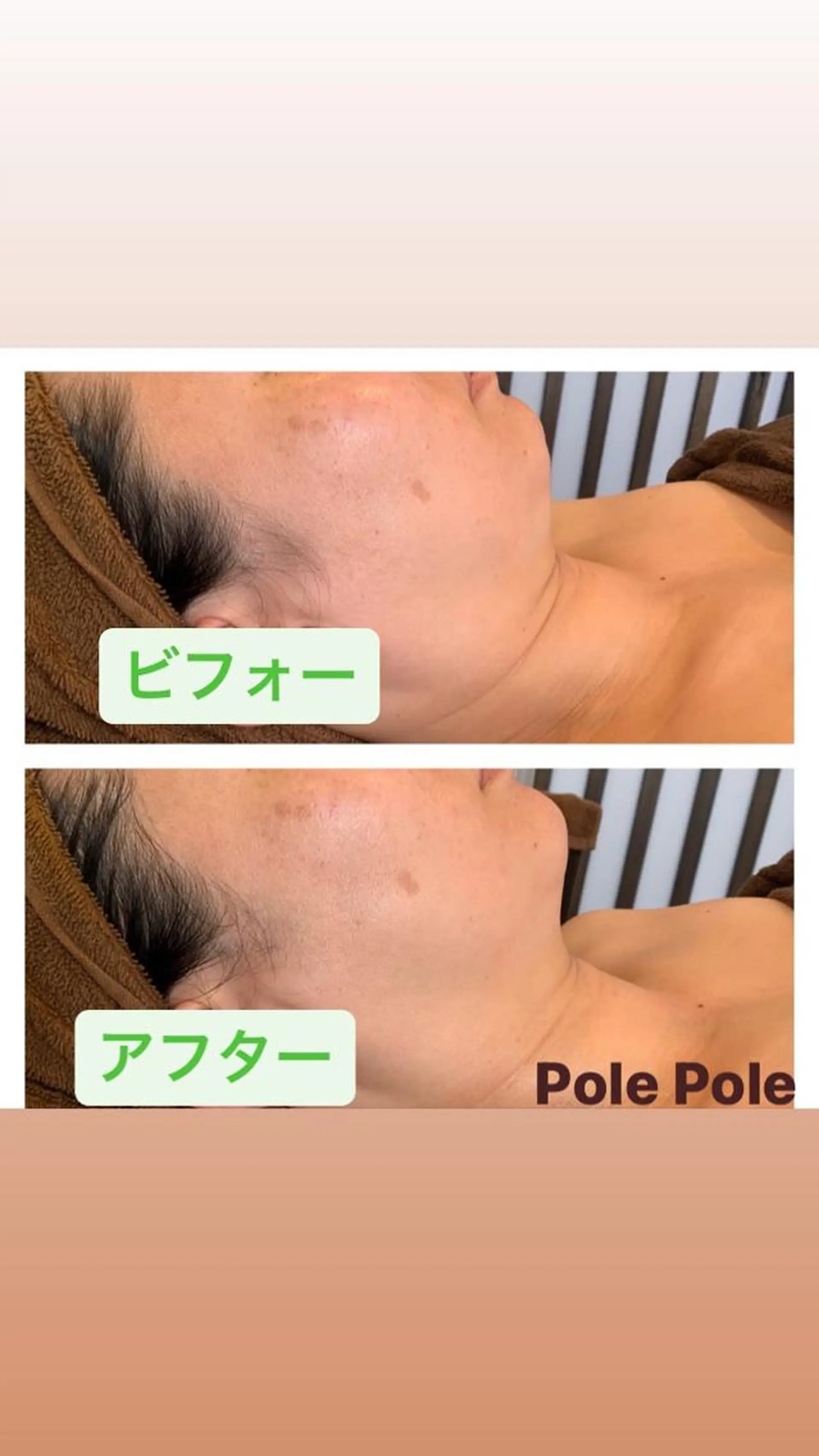 エステ Pole Poleのエステ・リラクイメージ