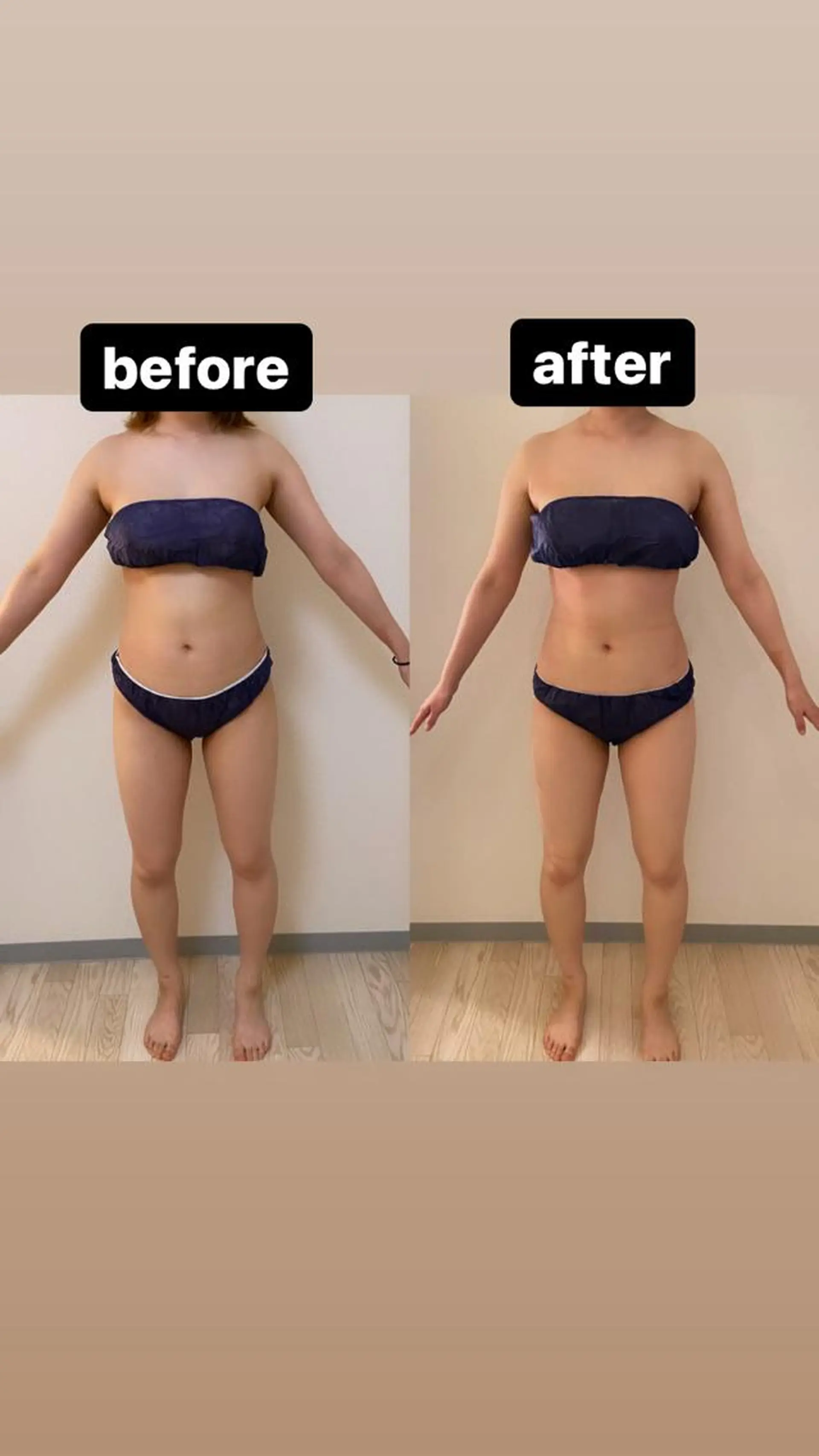 美容鍼WINBACK サロンRemeのエステ・リラクイメージ