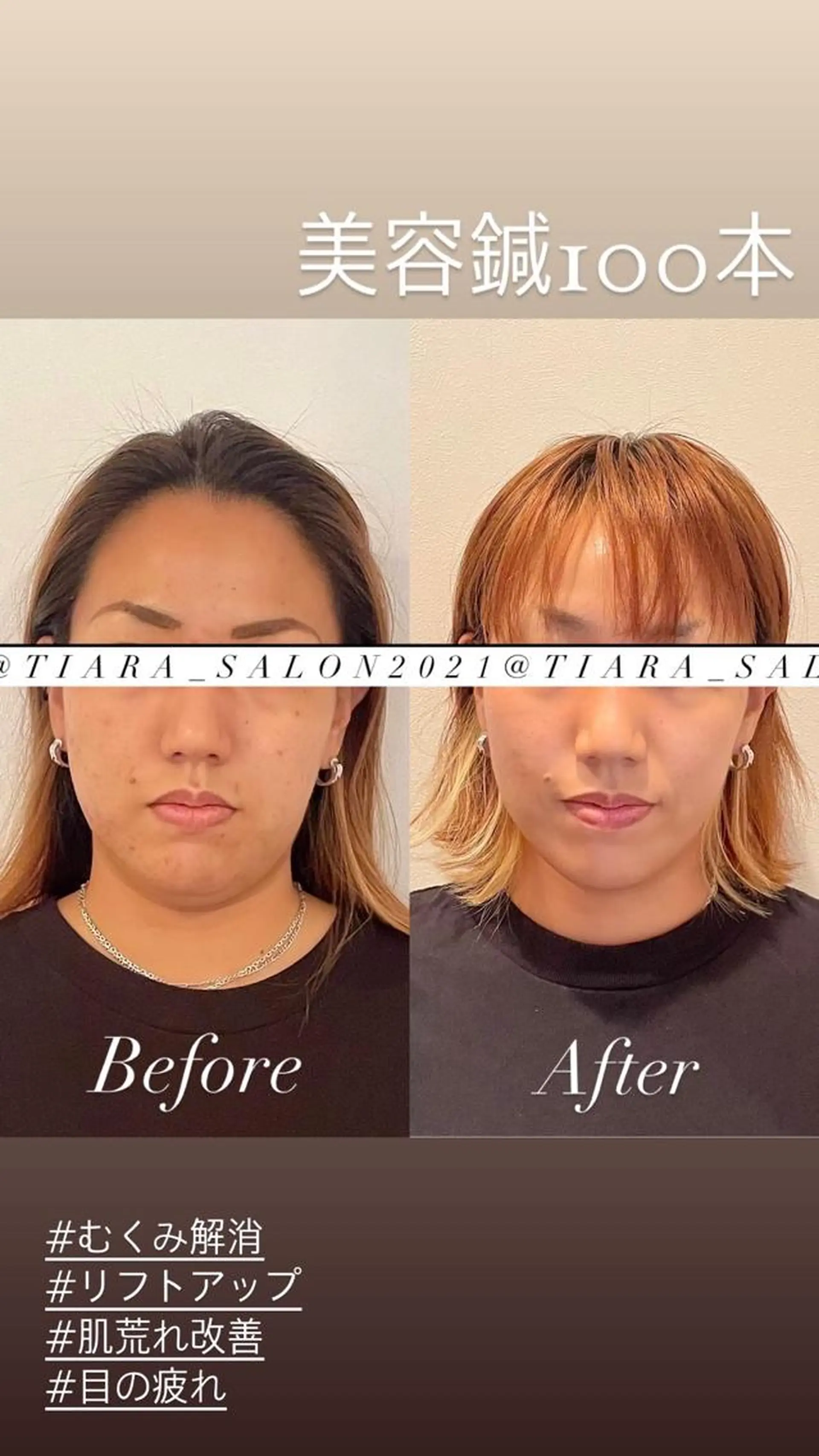 ミディアム カラー パーマ ヘアアレンジ メンズ キッズ ネイル マツエク・マツパ アイブロウ 鍼灸サロン TIARA　美容鍼のエステ・リラクイメージ