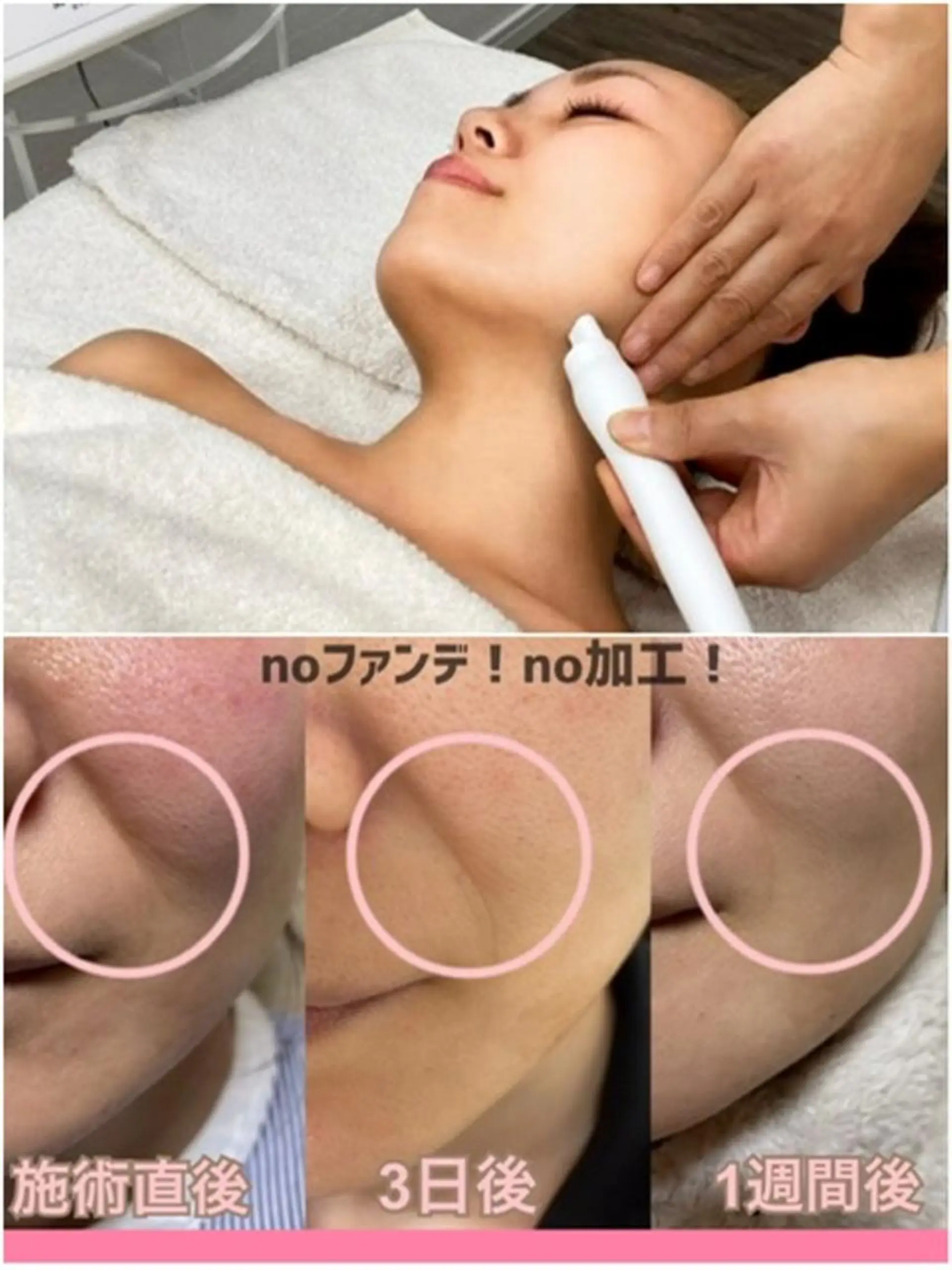 エステ 肌ケア＆毛穴洗浄 Cheri/女性専用のエステ・リラクイメージ