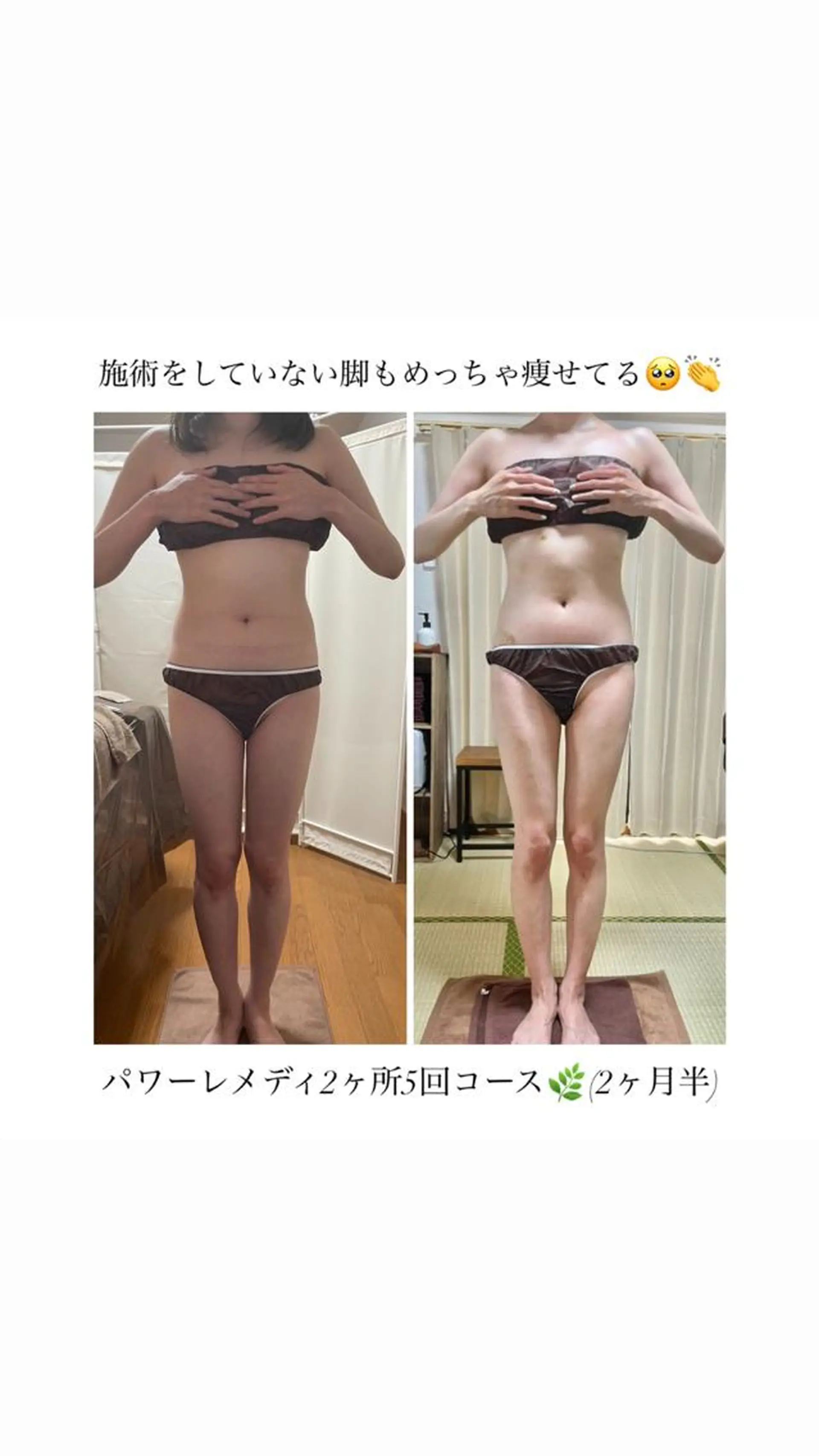 《本気痩せ×疲労改善 》  BILOOPのエステ・リラクイメージ