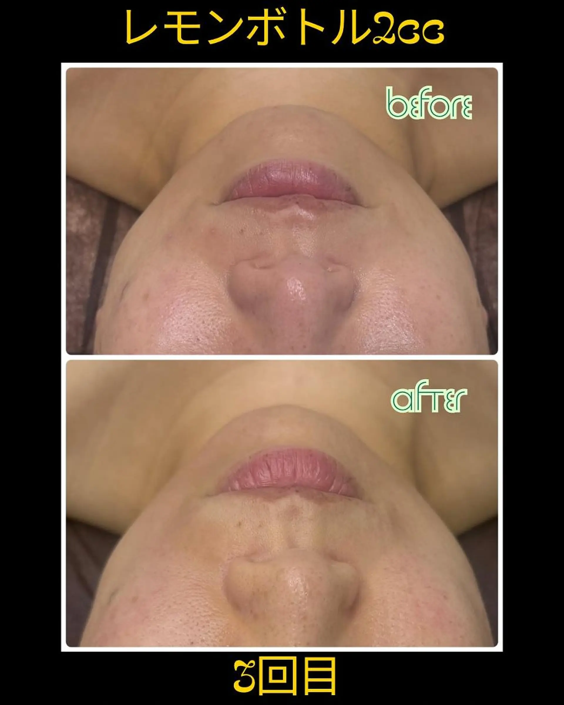 ラブニール 恵比寿店のエステ・リラクイメージ