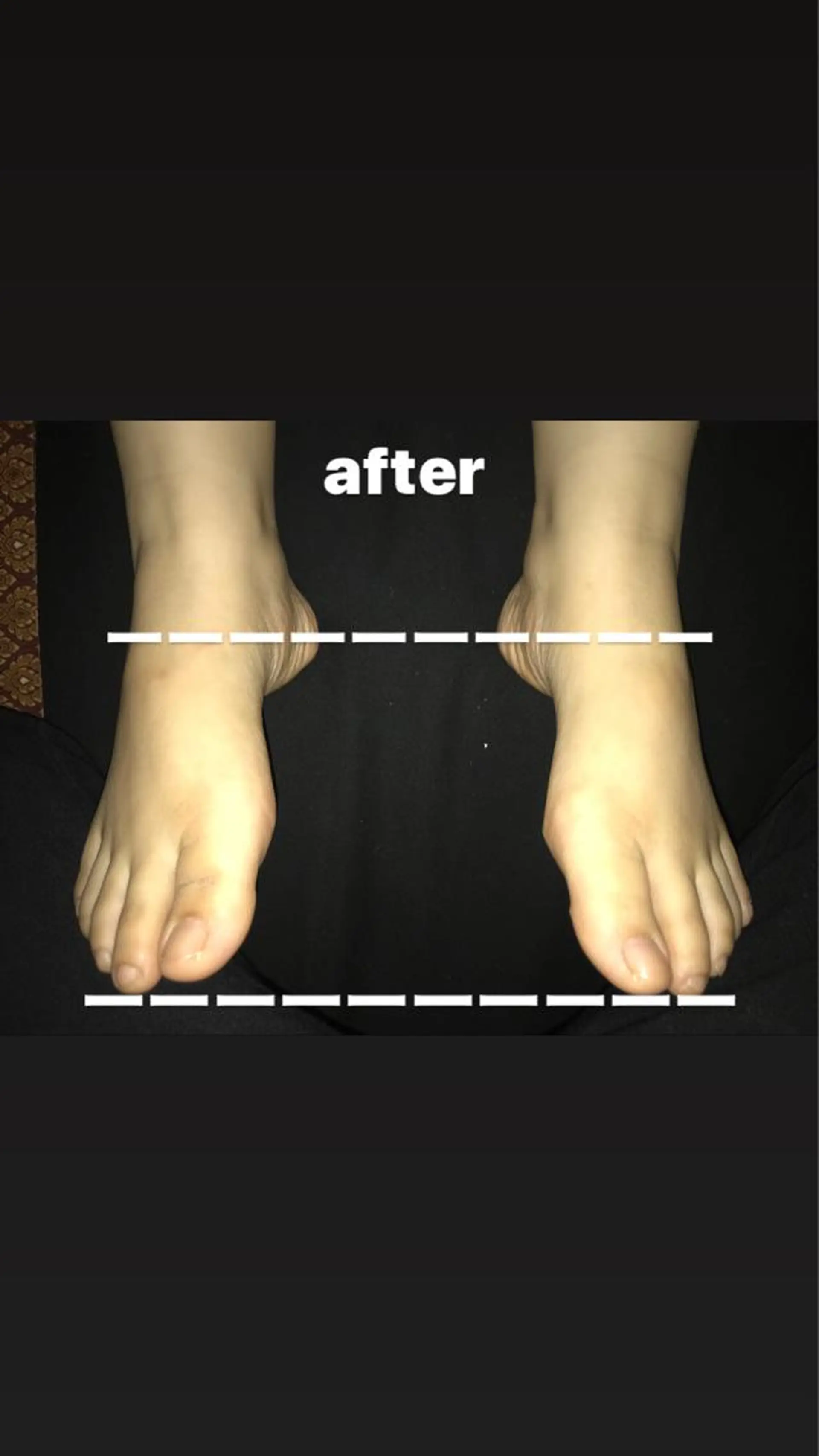 リラク 【足圧】鬼👹リンパ 身体整うサロンのエステ・リラクイメージ