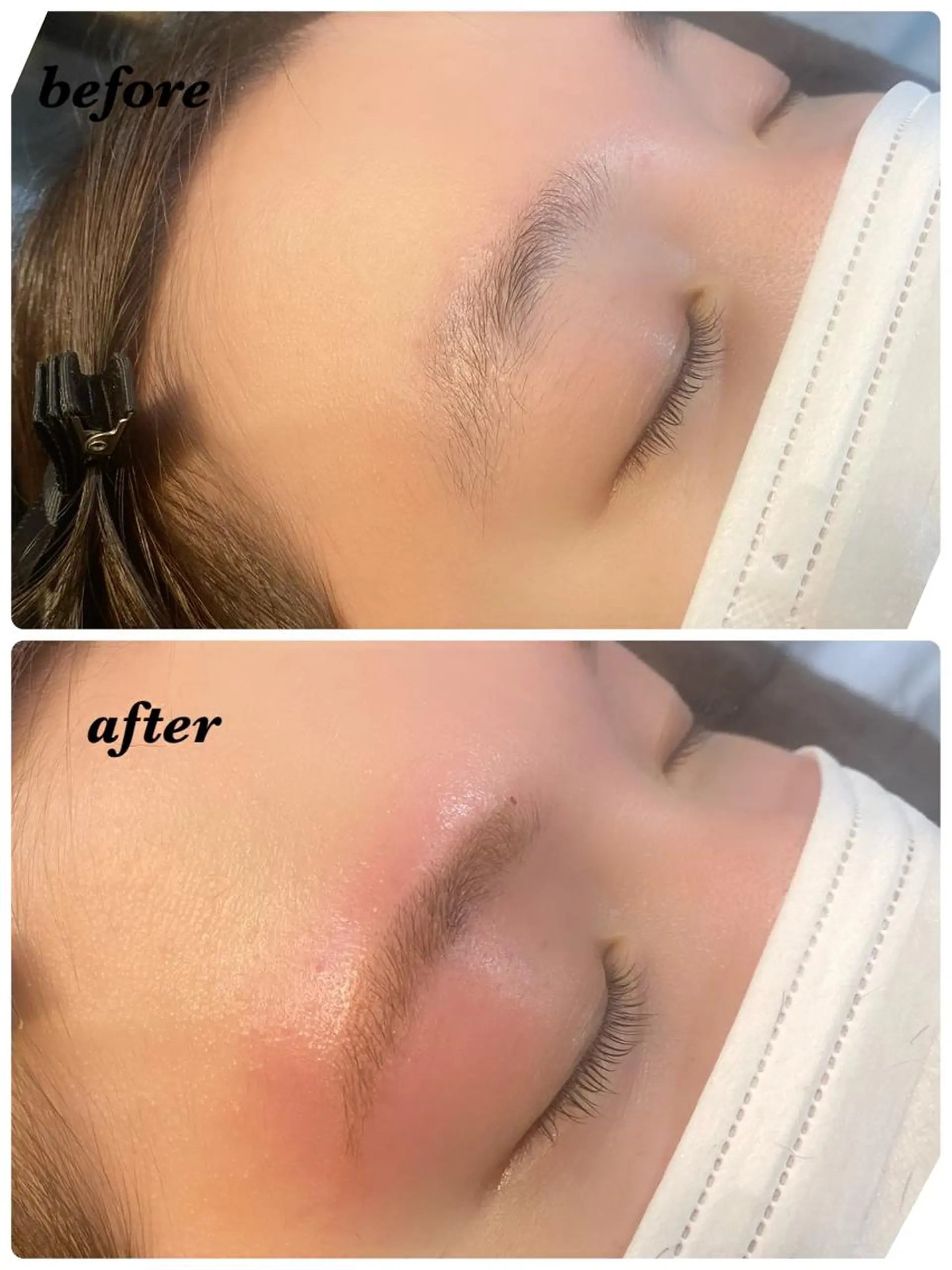 アイブロウ ハーブピーリング/韓国肌管理/フェイシャル/毛穴洗浄/眉毛/顔脱毛【糸脱毛専門】rev所属・ハーブピーリング専門 毛穴洗浄❤️眉waxのエステ・リラクイメージ