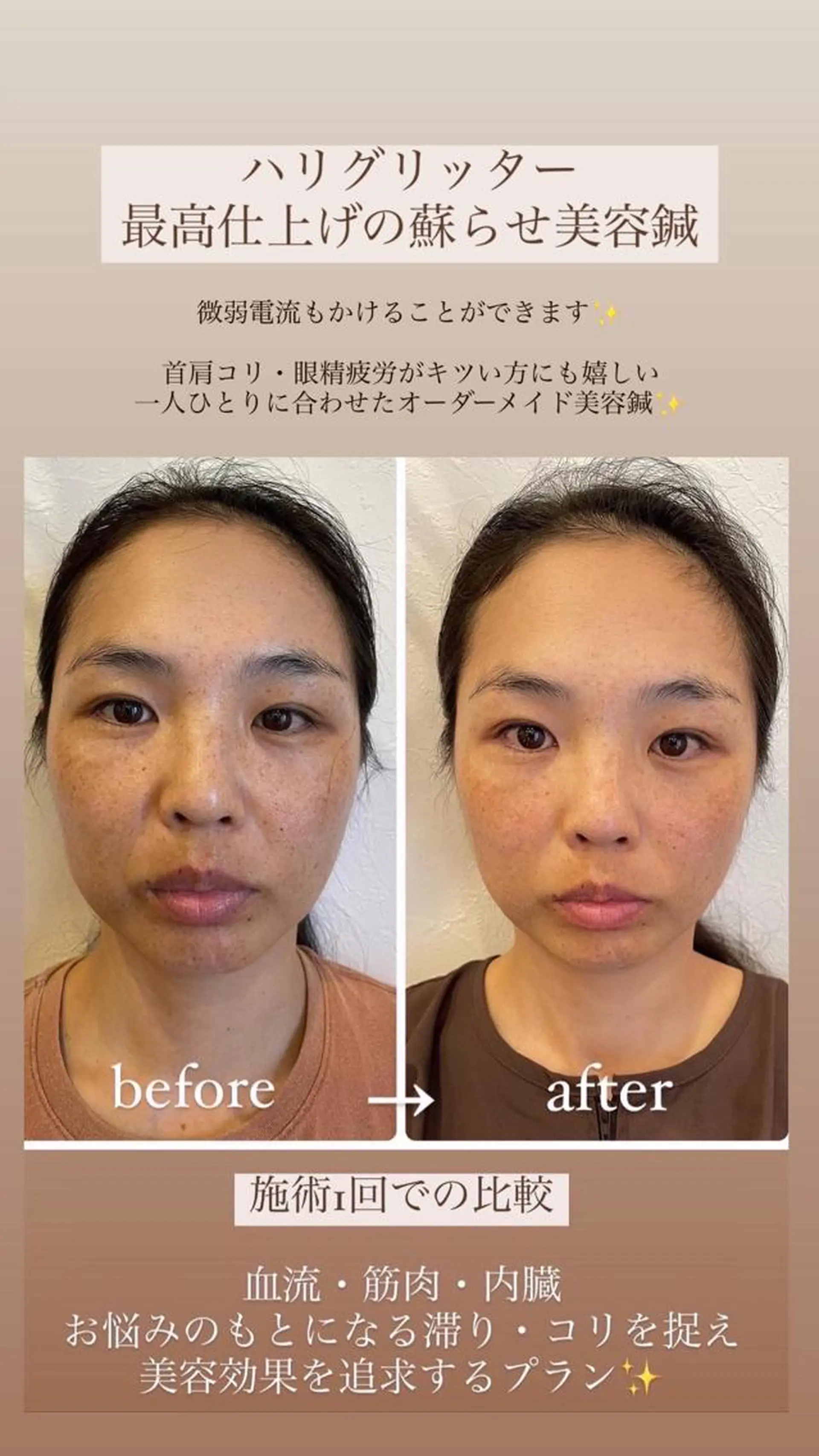 美容鍼・鍼灸専門❤✨ 近藤めぐみのエステ・リラクイメージ