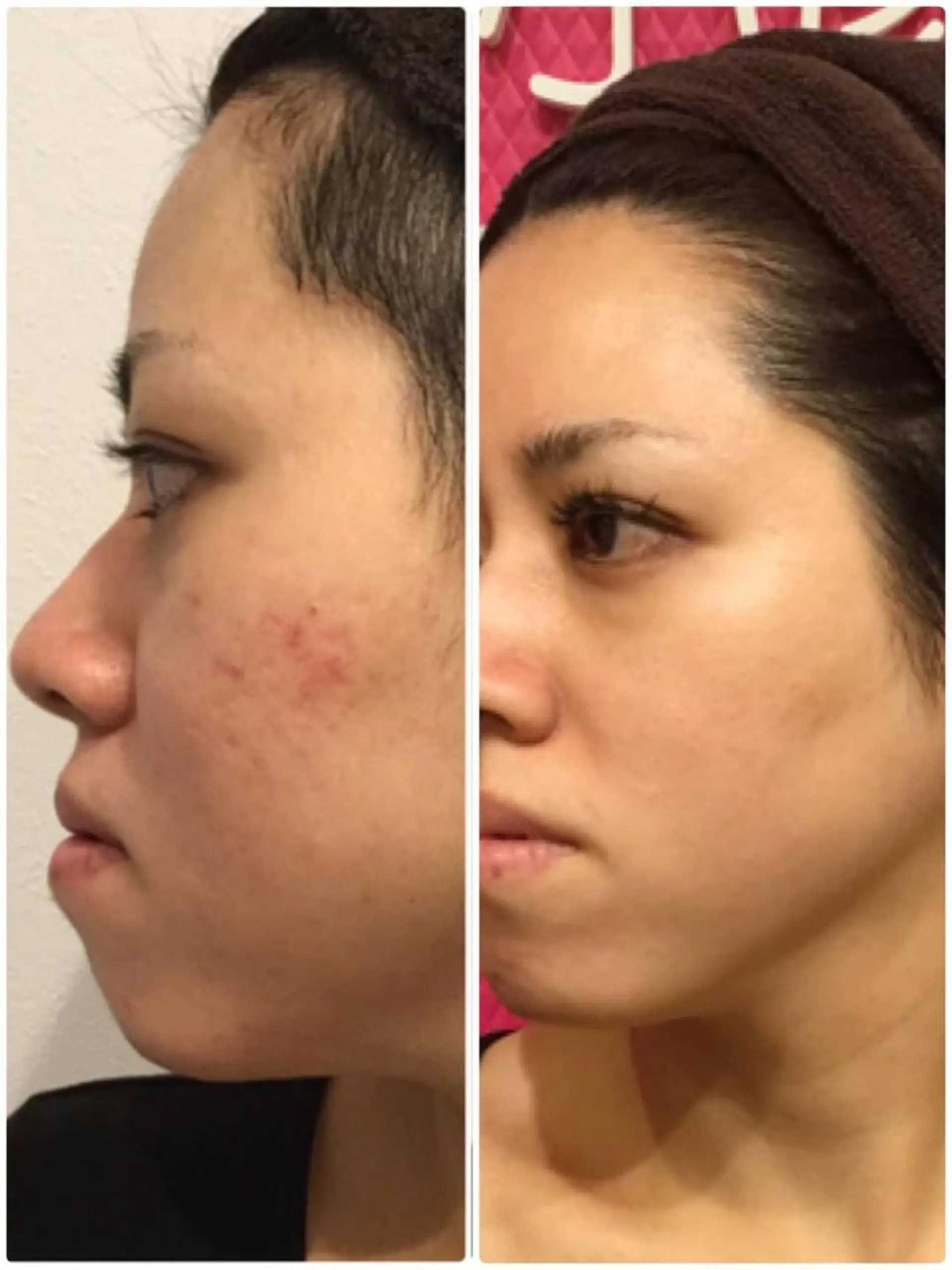 その他 アロマ•ピーリング SalonYokoのその他イメージ