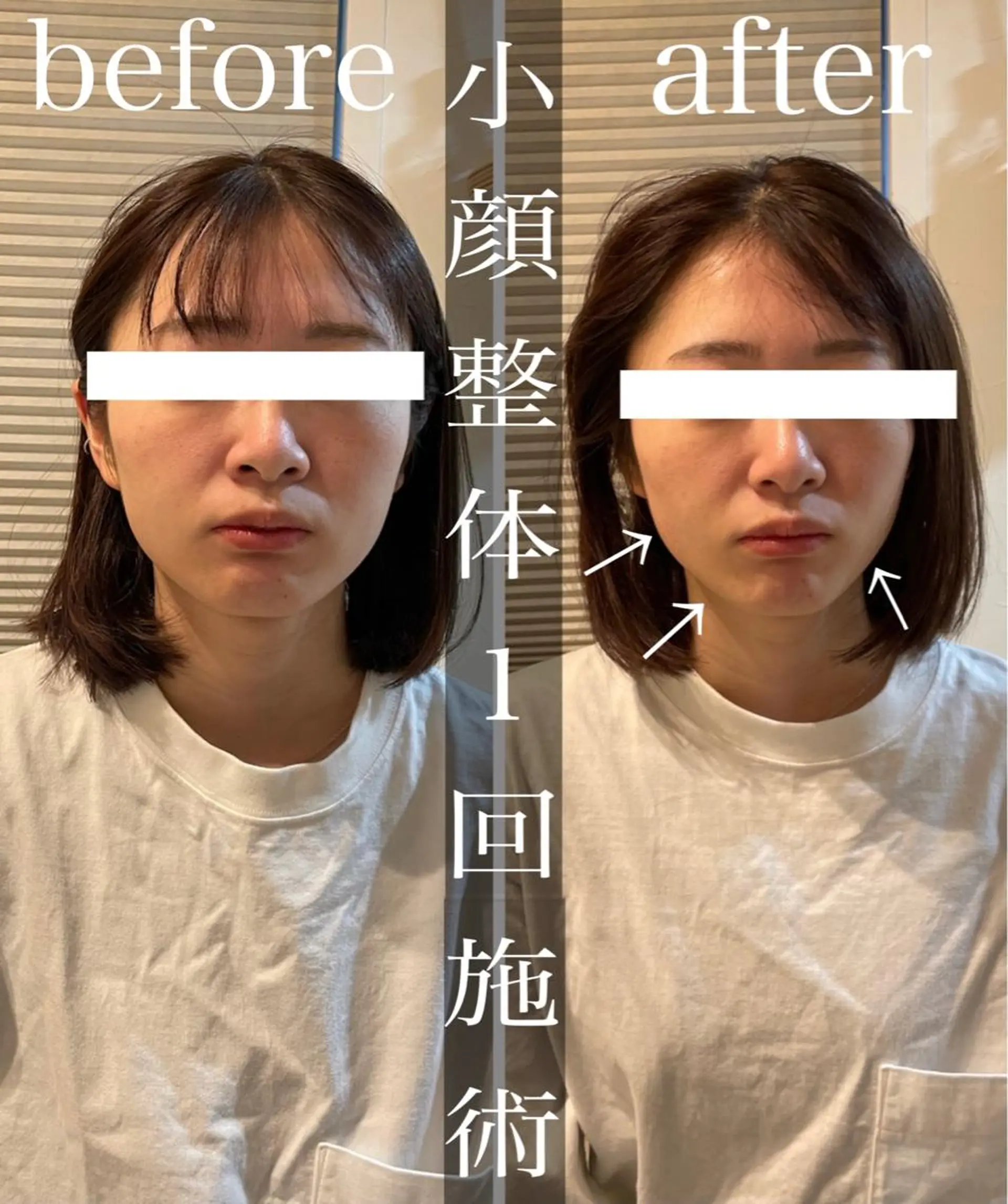 その他 鍼灸整骨院Refine所属・鍼灸 Refineのその他イメージ