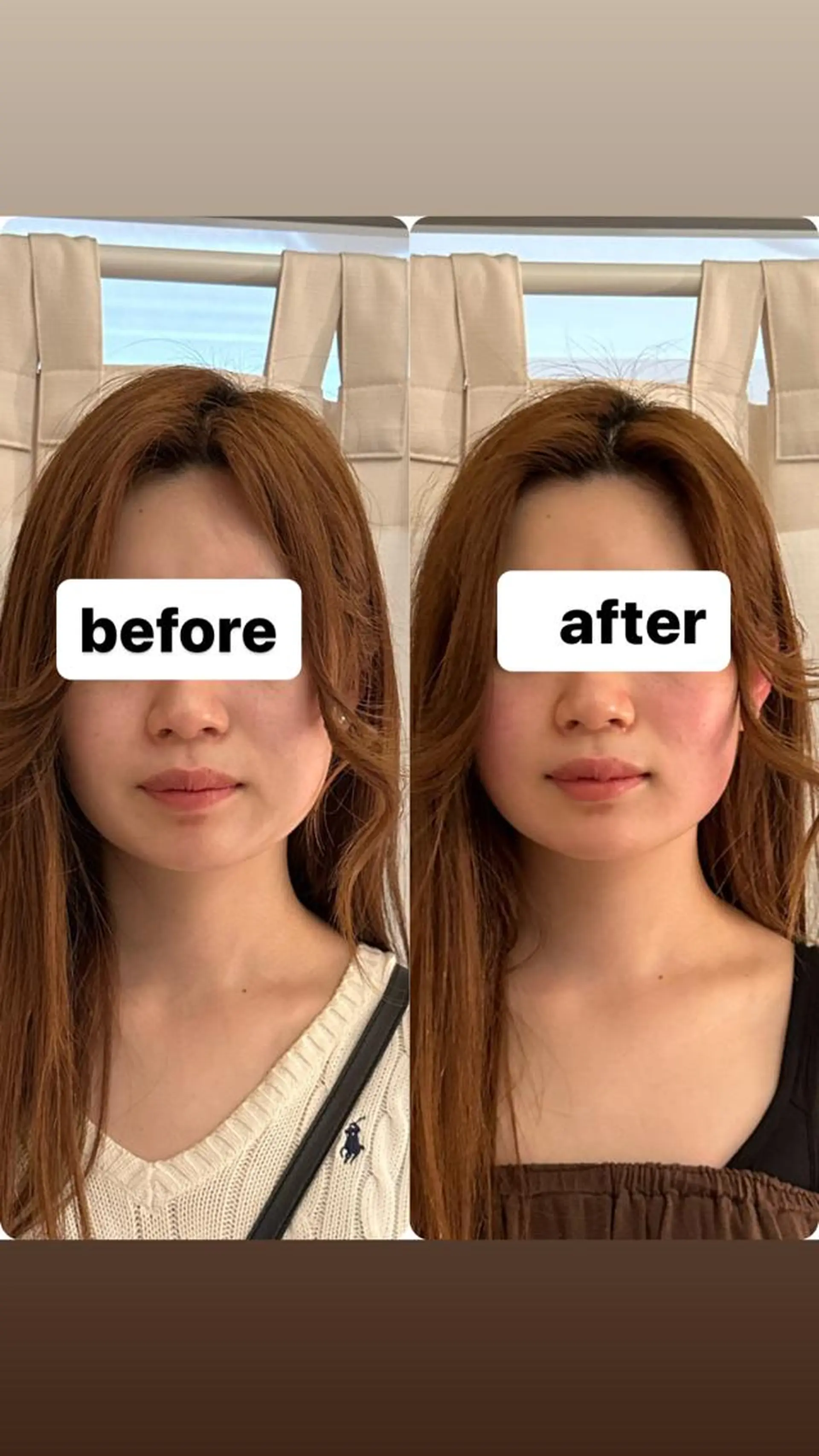 エステ リラク 美容鍼WINBACK サロンRemeのエステ・リラクイメージ