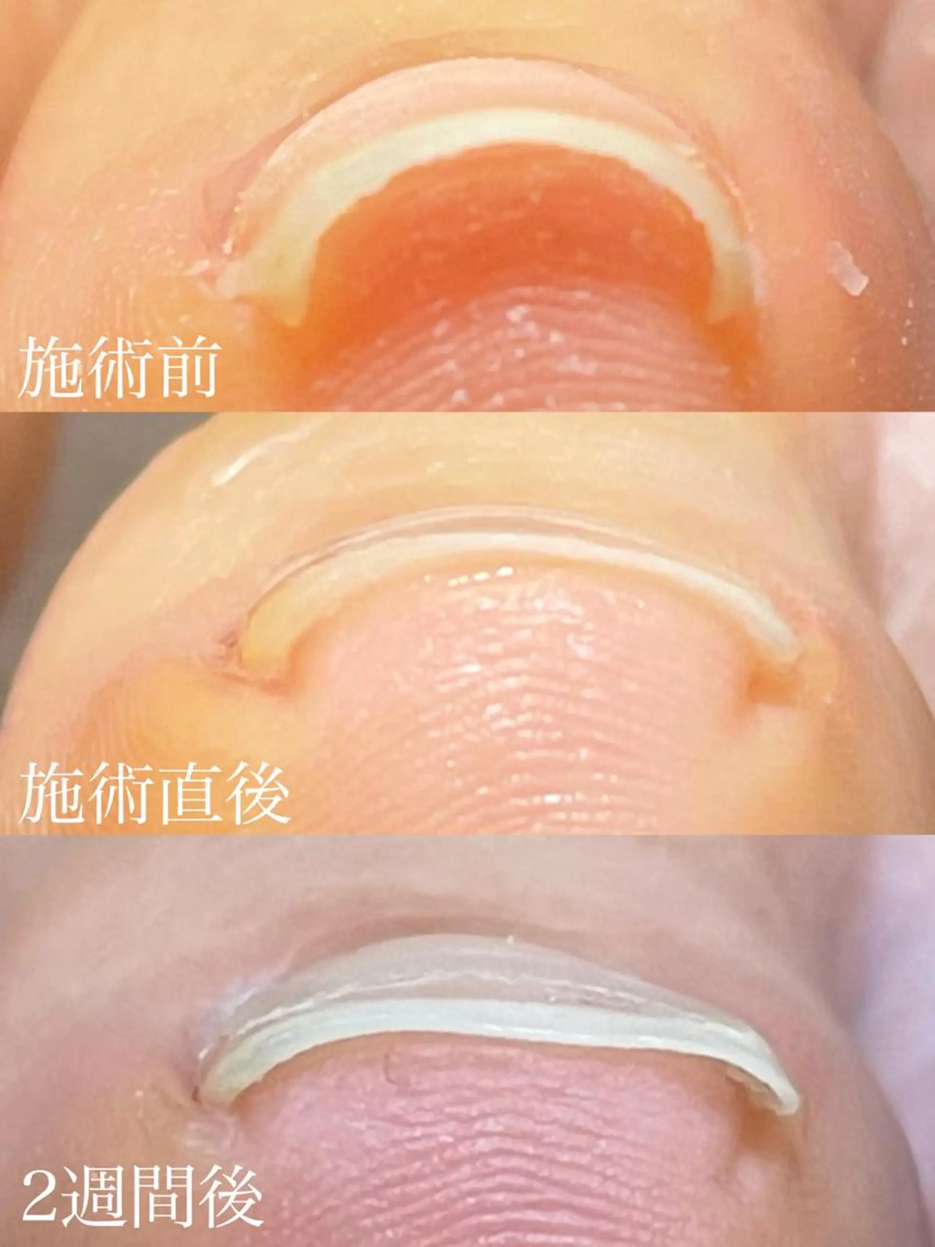 ネイル ルリアンチッタ 眉毛/まつげパーマの眉毛・アイブロウイメージ