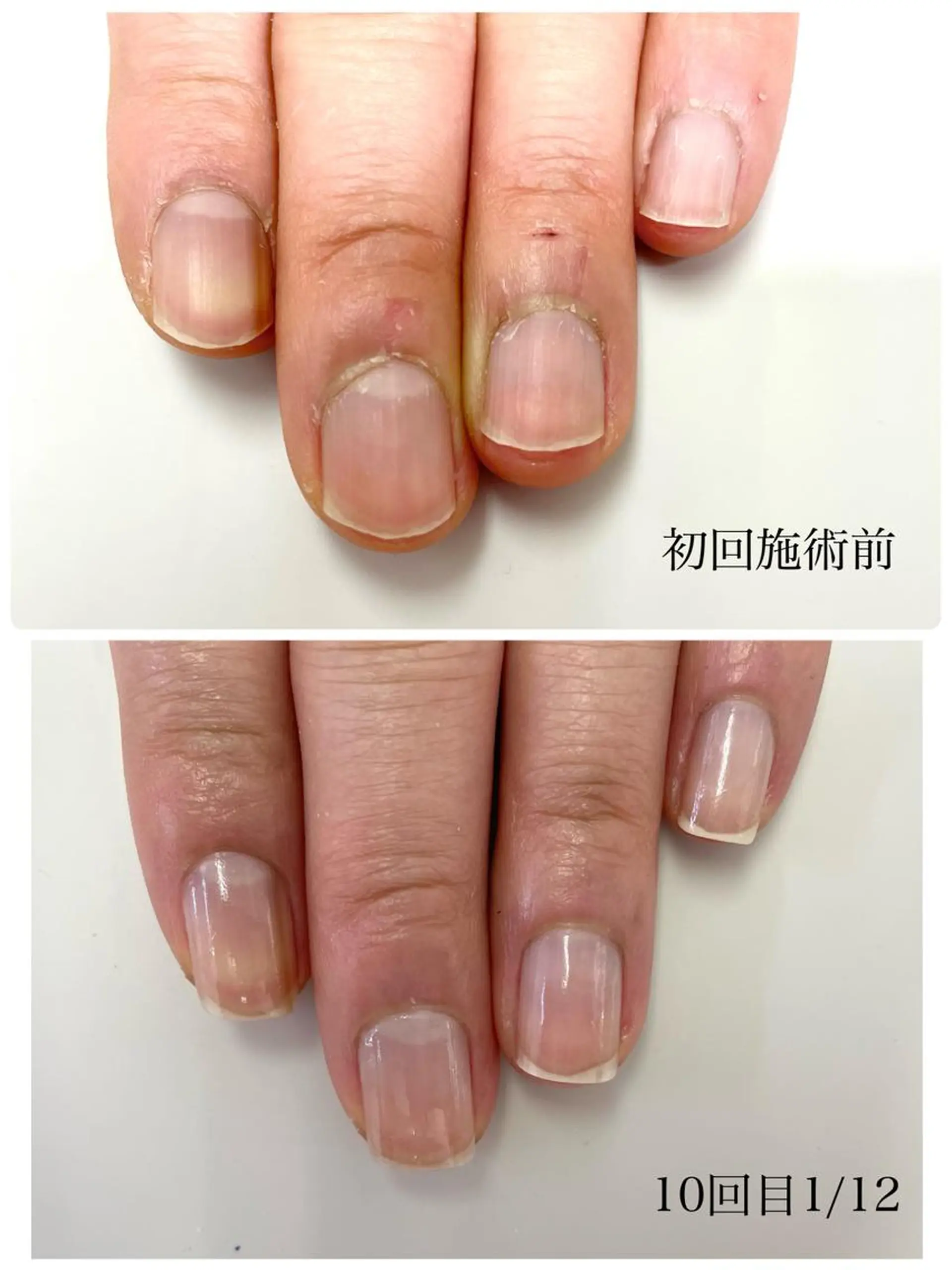 ネイル TiALASH ＊Kozue＊のネイルデザイン