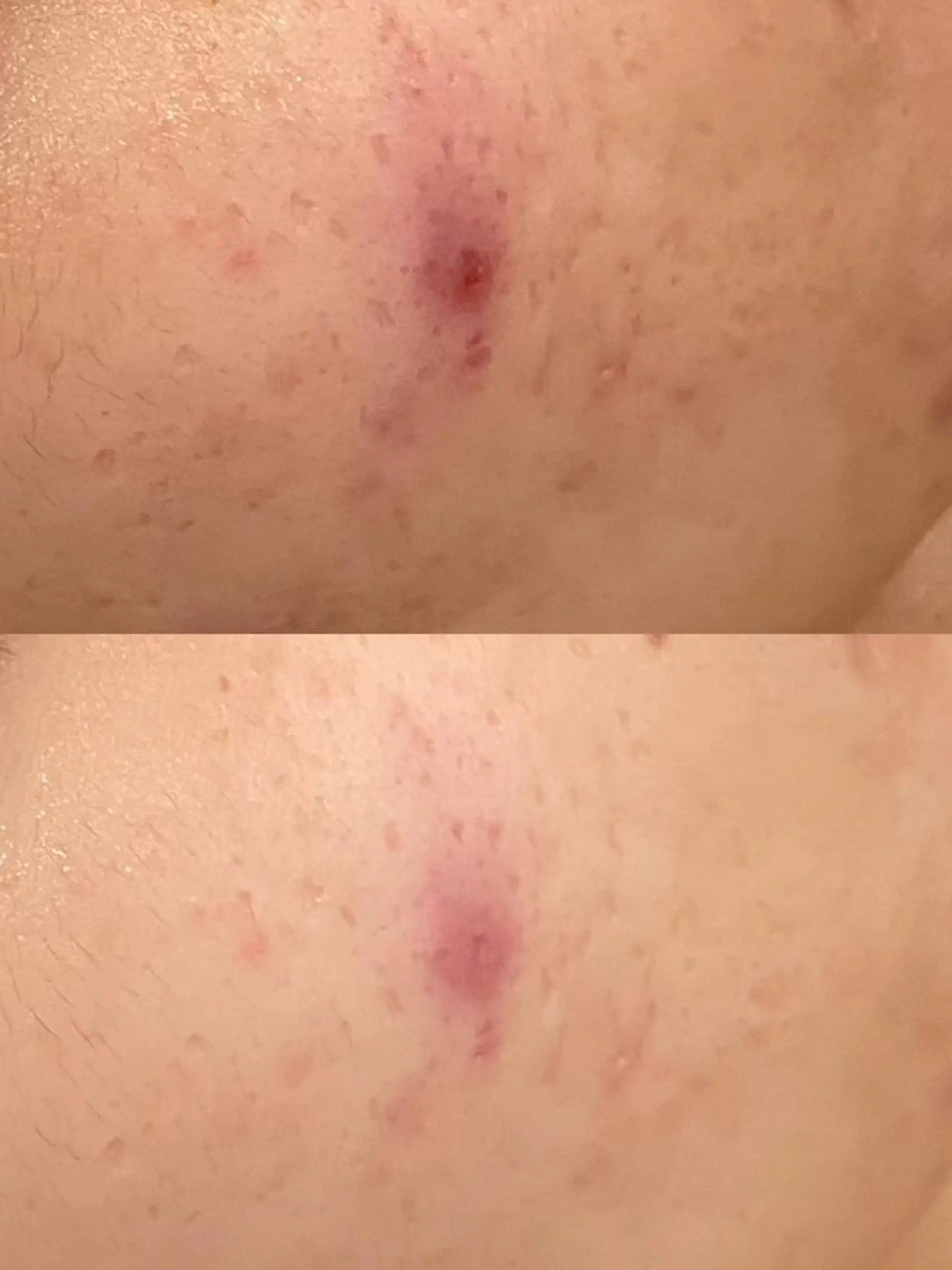 エステ リラク メナードフェイシャル サロン片町店ハタケのエステ・リラクイメージ